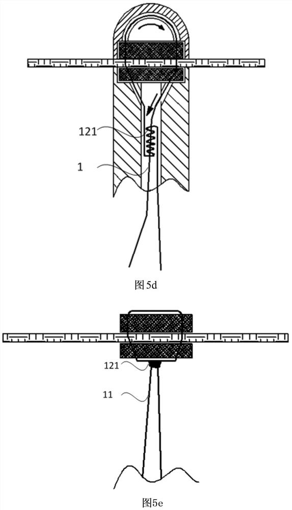 Implant and assembly for forming implant