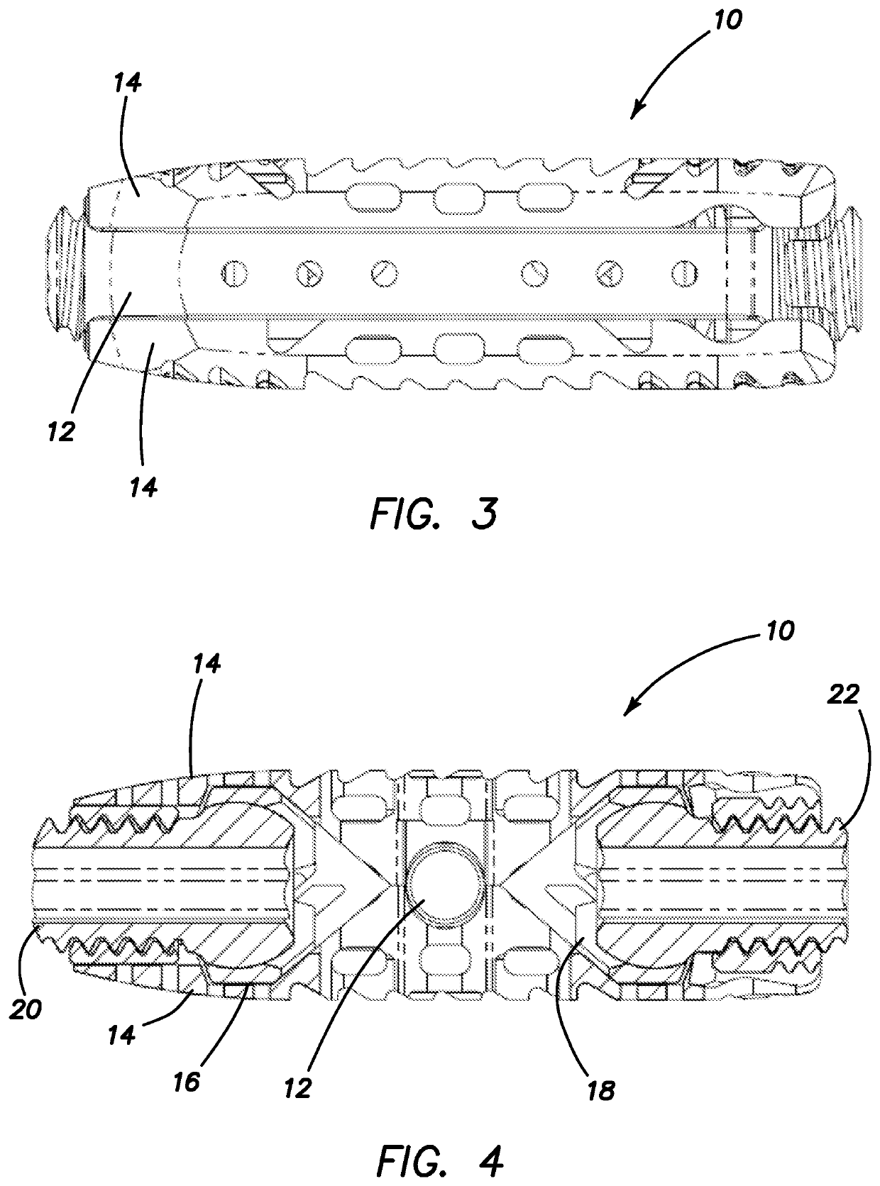 Expandable interbody spacer