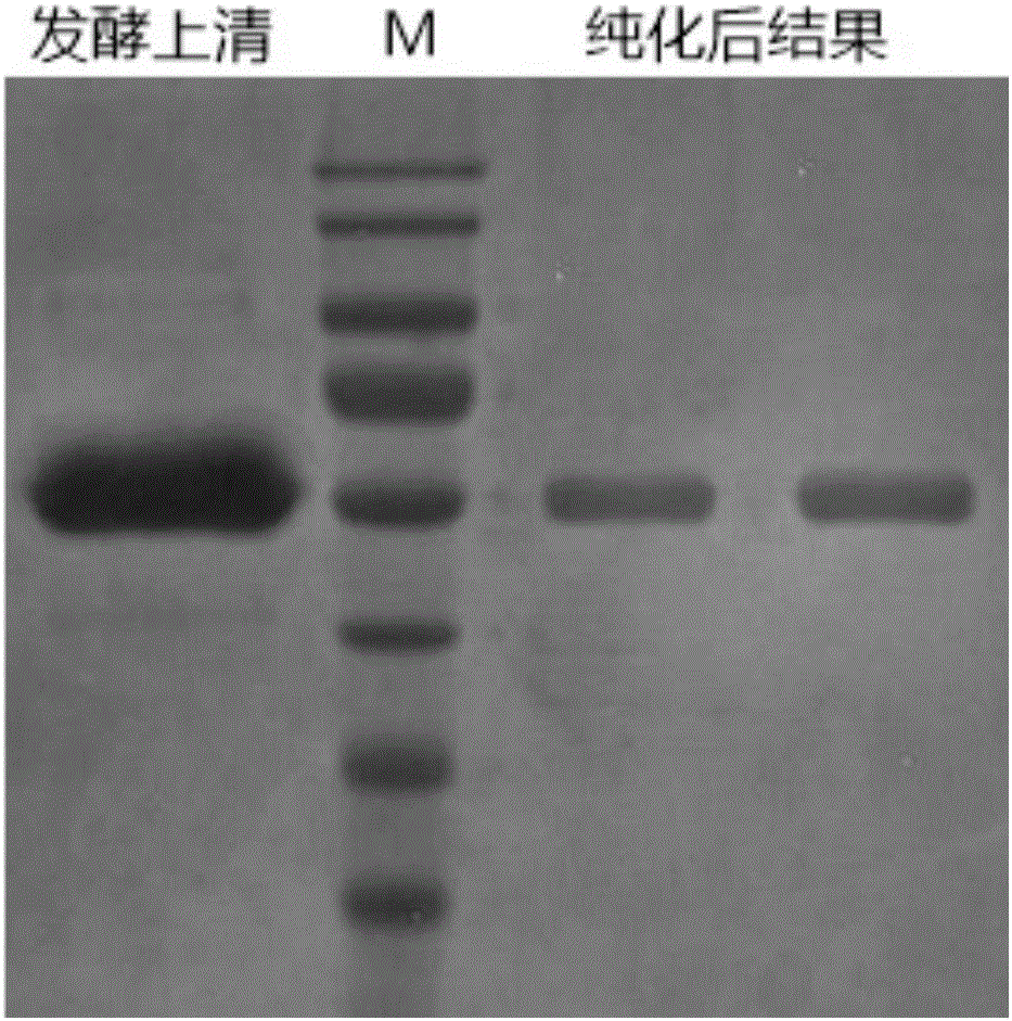 Recombinant human collagen and its coding gene and preparation method thereof