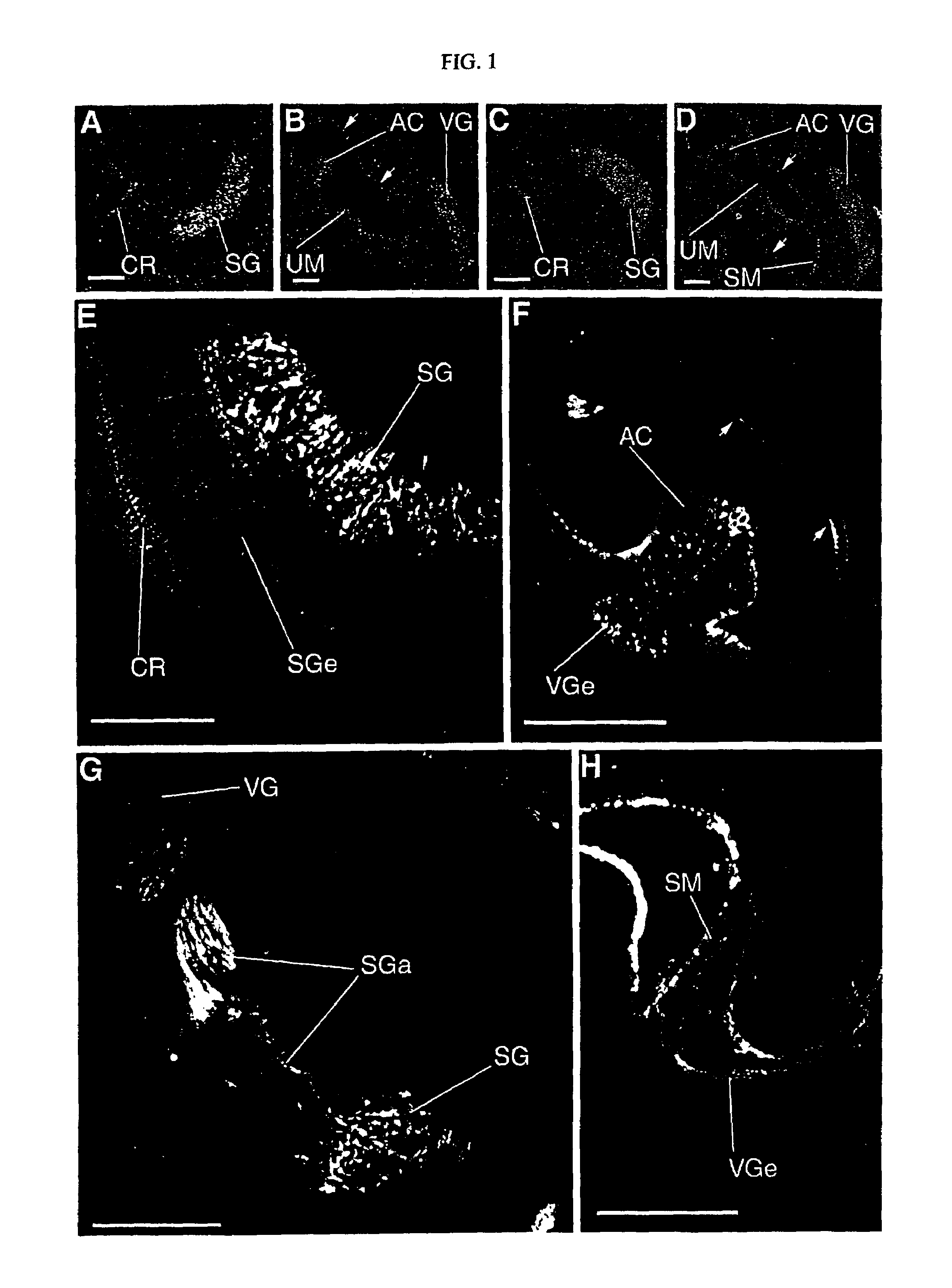 Screening method for agonists or antagonists of semaphorin 6C by determining the effect of a test compound on the interaction between semaphorin 6C and plexin-A1