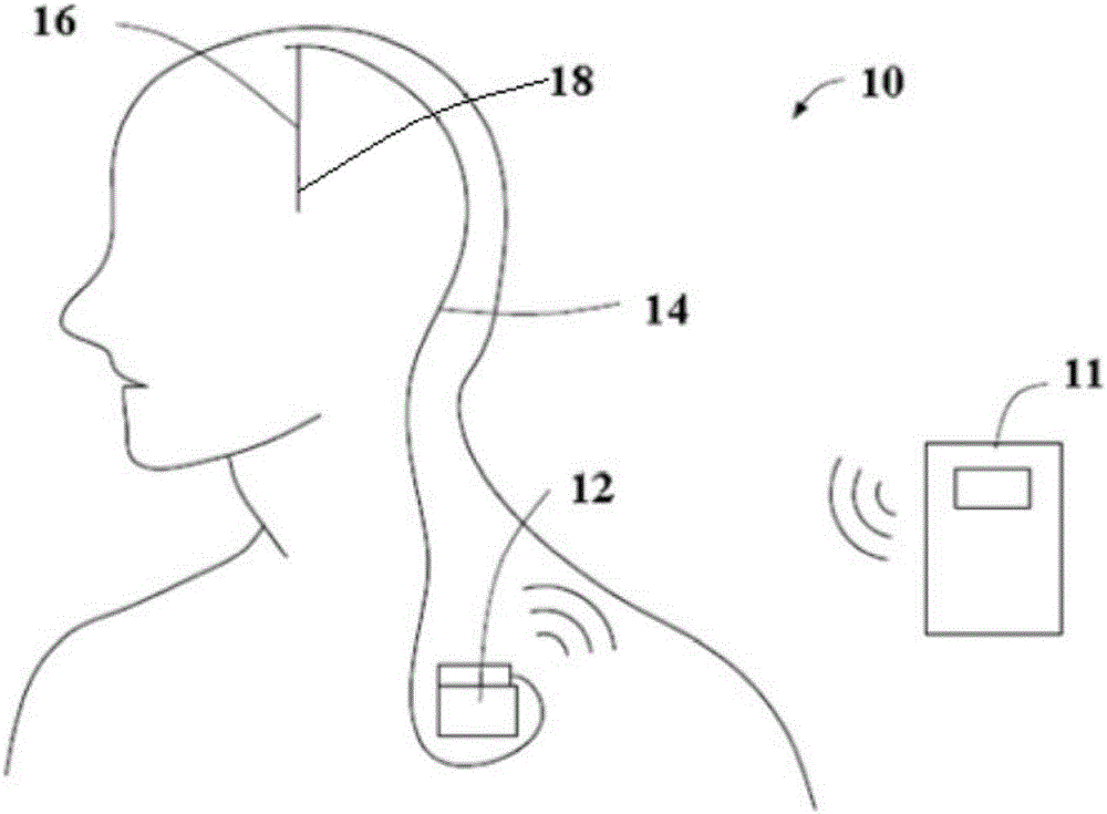 Method for monitoring temperatures of tissues around active implantation object and magnetic resonance imaging system