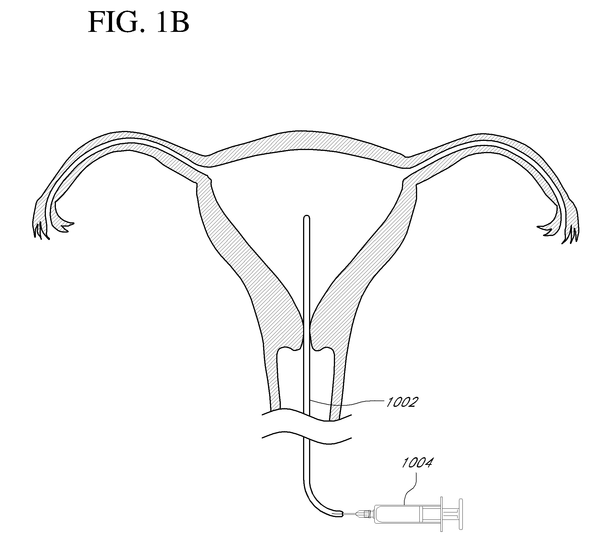 Systems, methods and devices for performing gynecological procedures