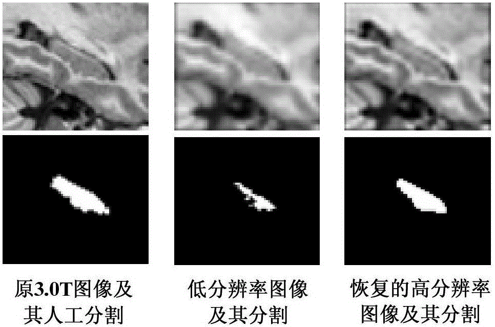 Multi-atlas dividing method for low-resolution medical image