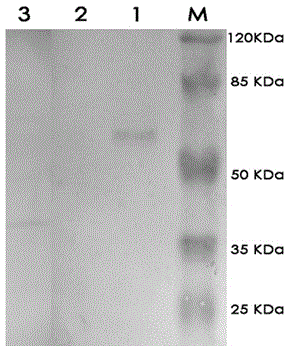 Monoclonal antibody of toxoplasma gondii resistant MIC3 protein and application monoclonal antibody