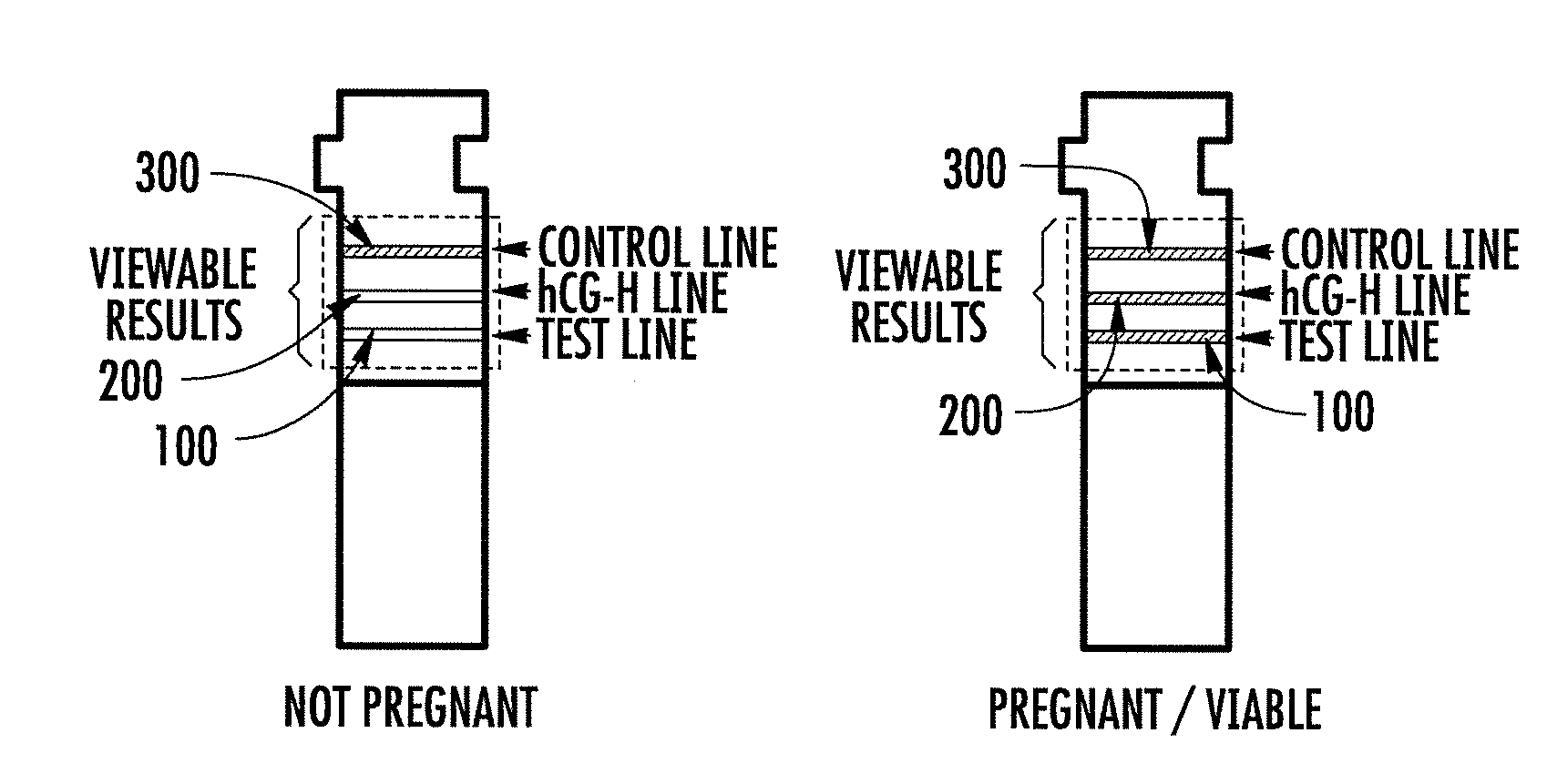 Hyperglycosylated hcg detection device