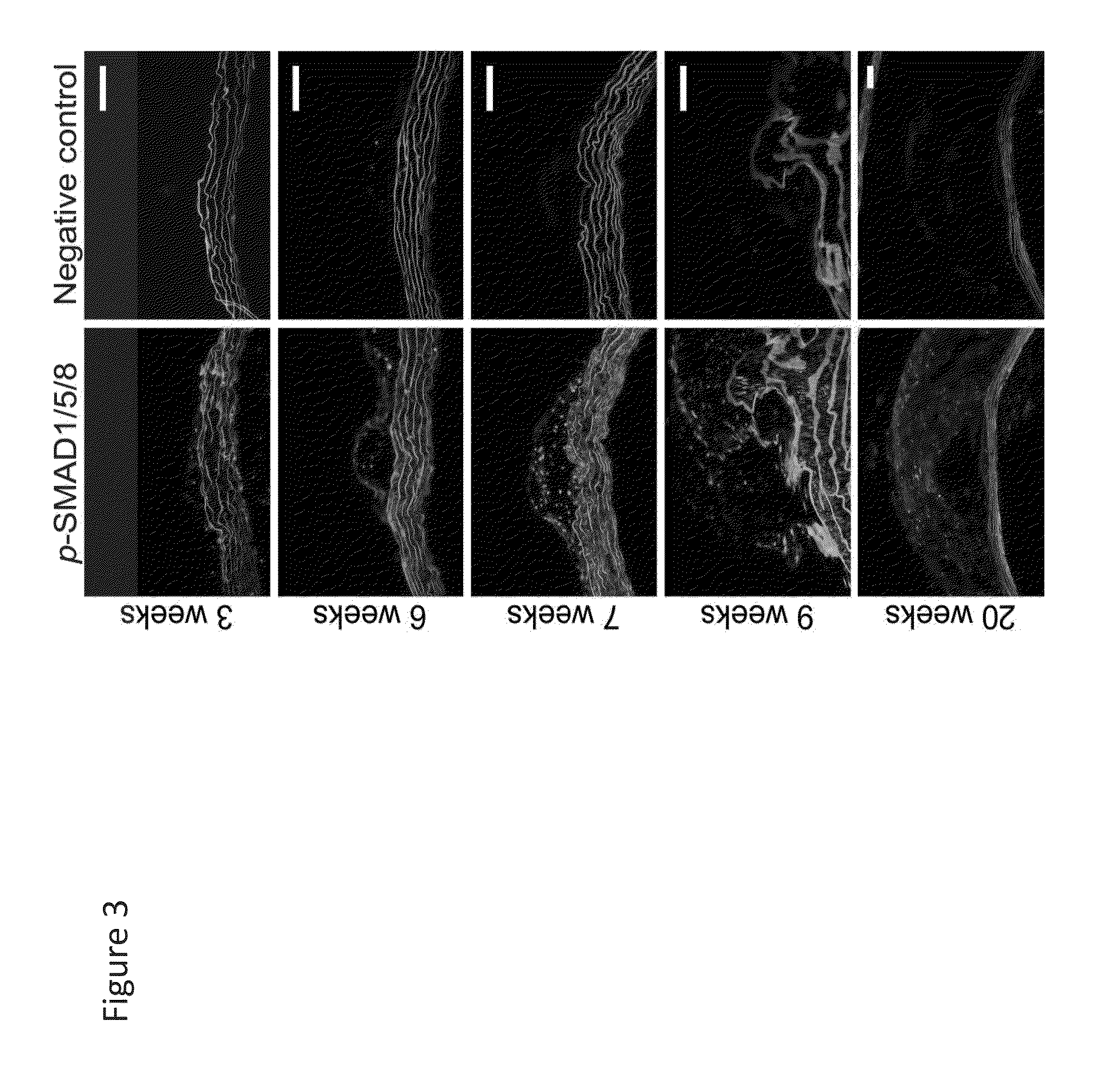 Compositions and methods for cardiovascular disease
