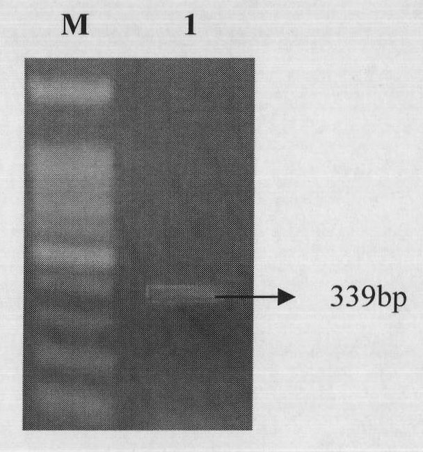 Method for testing microcystin (MC) toxin in M1rA gene cDNA sequence, deduced amino acid and water body