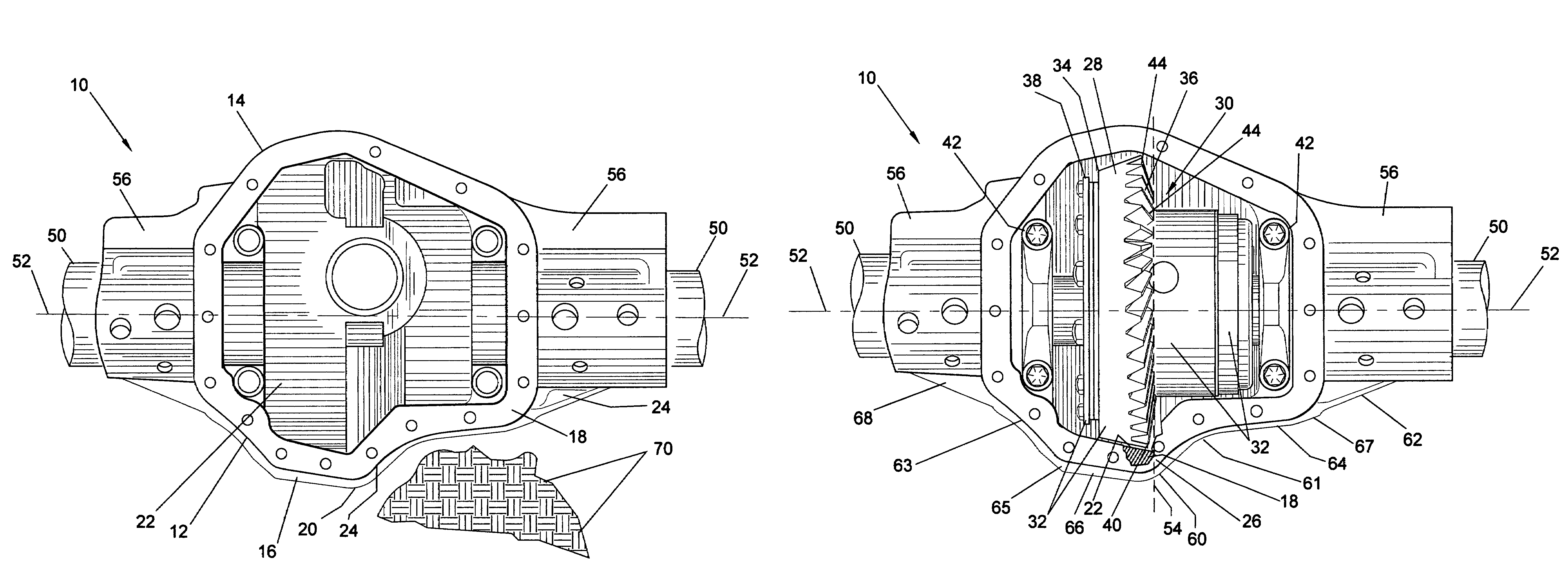 Method for structuring a gear assembly housing