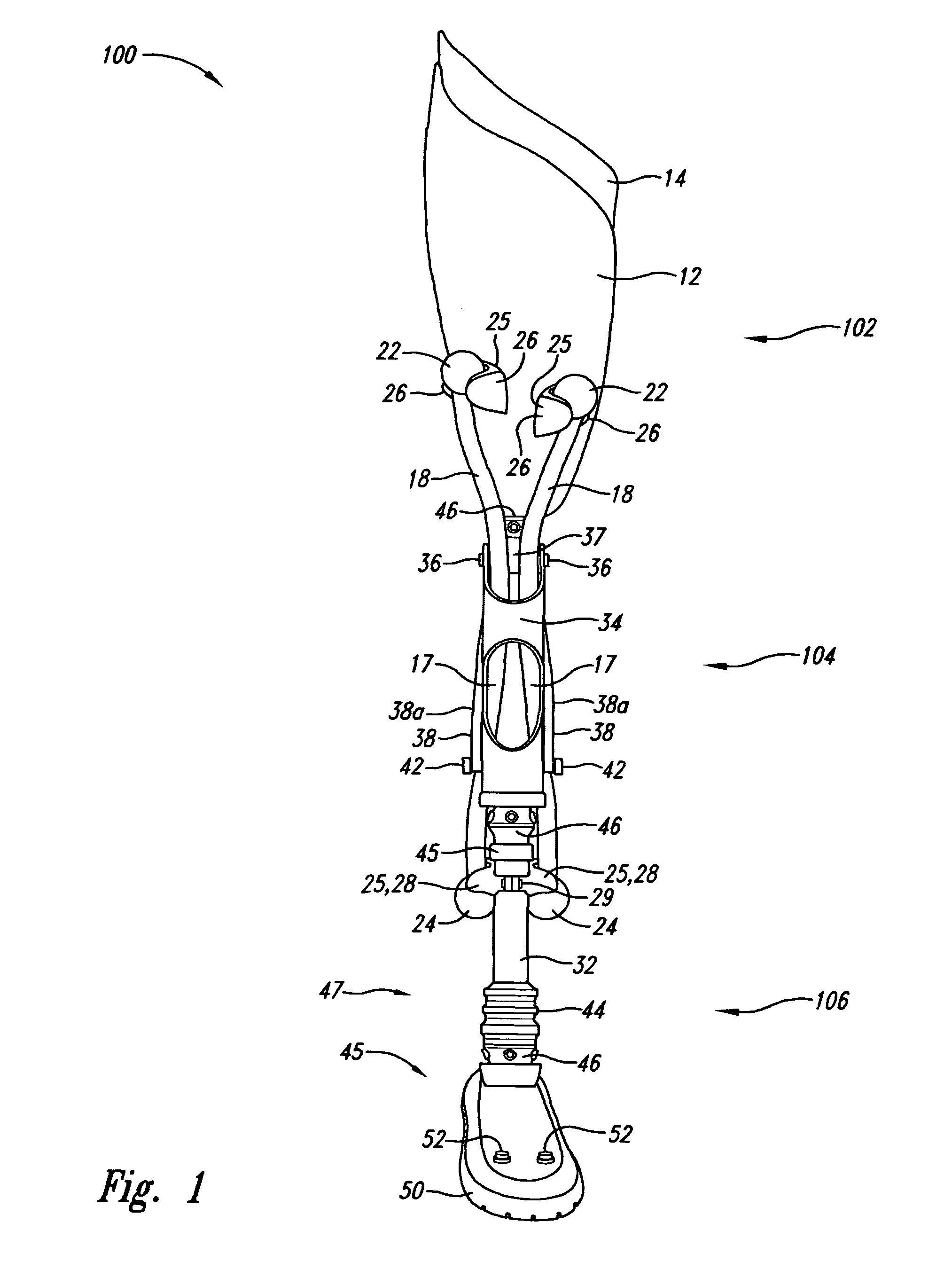 Limb prosthesis system and method