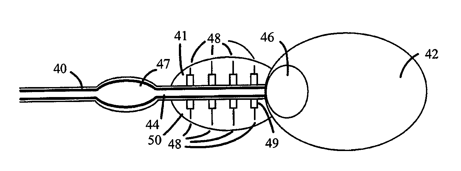 Non-Thermal Ablation System for Treating Tissue