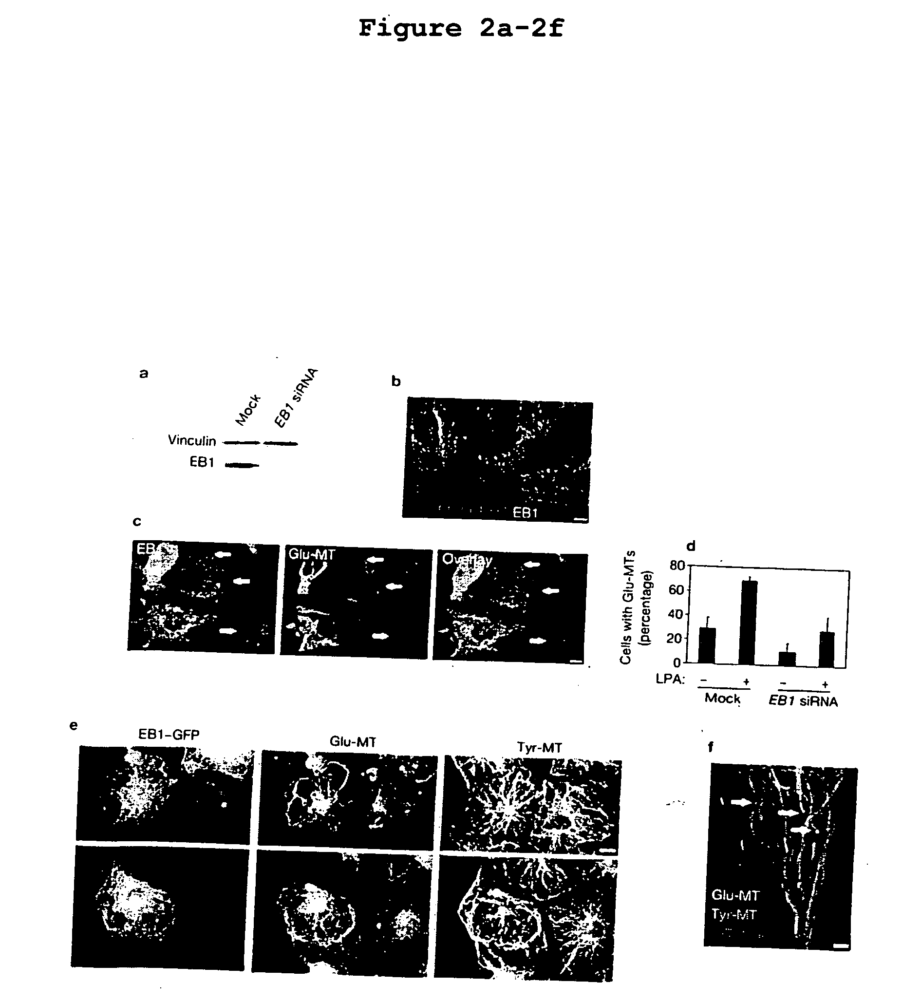 EB1-related compositions and methods
