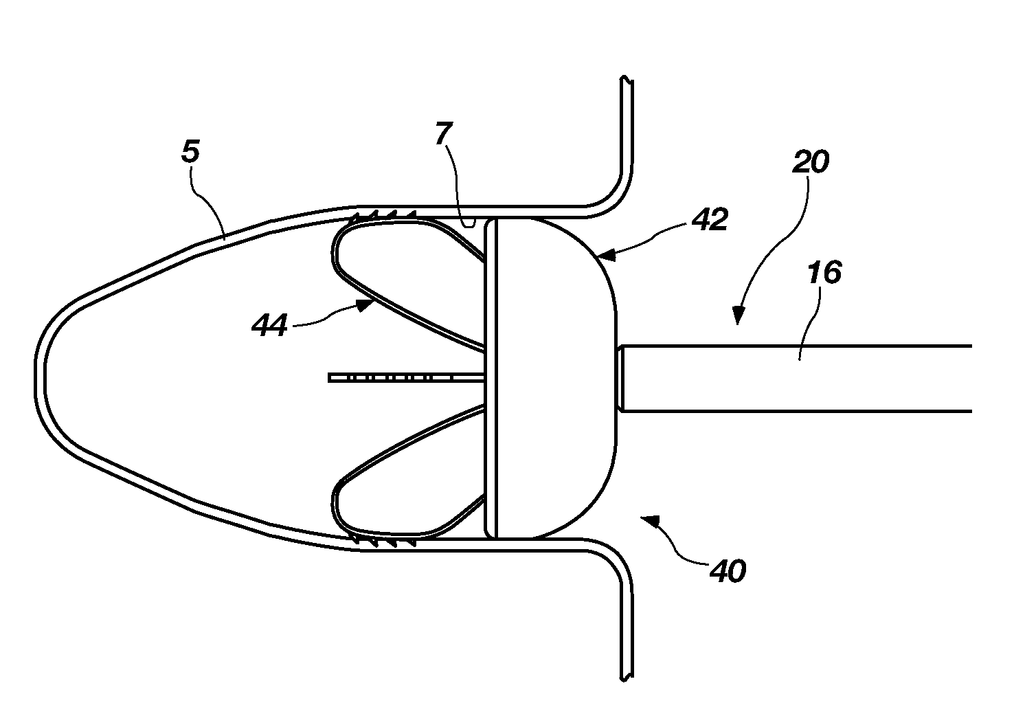 Medical Device and Delivery System for Modification of Left Atrial Appendage and Methods Thereof