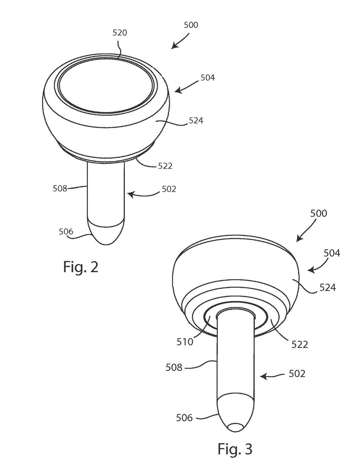 Radial head implant