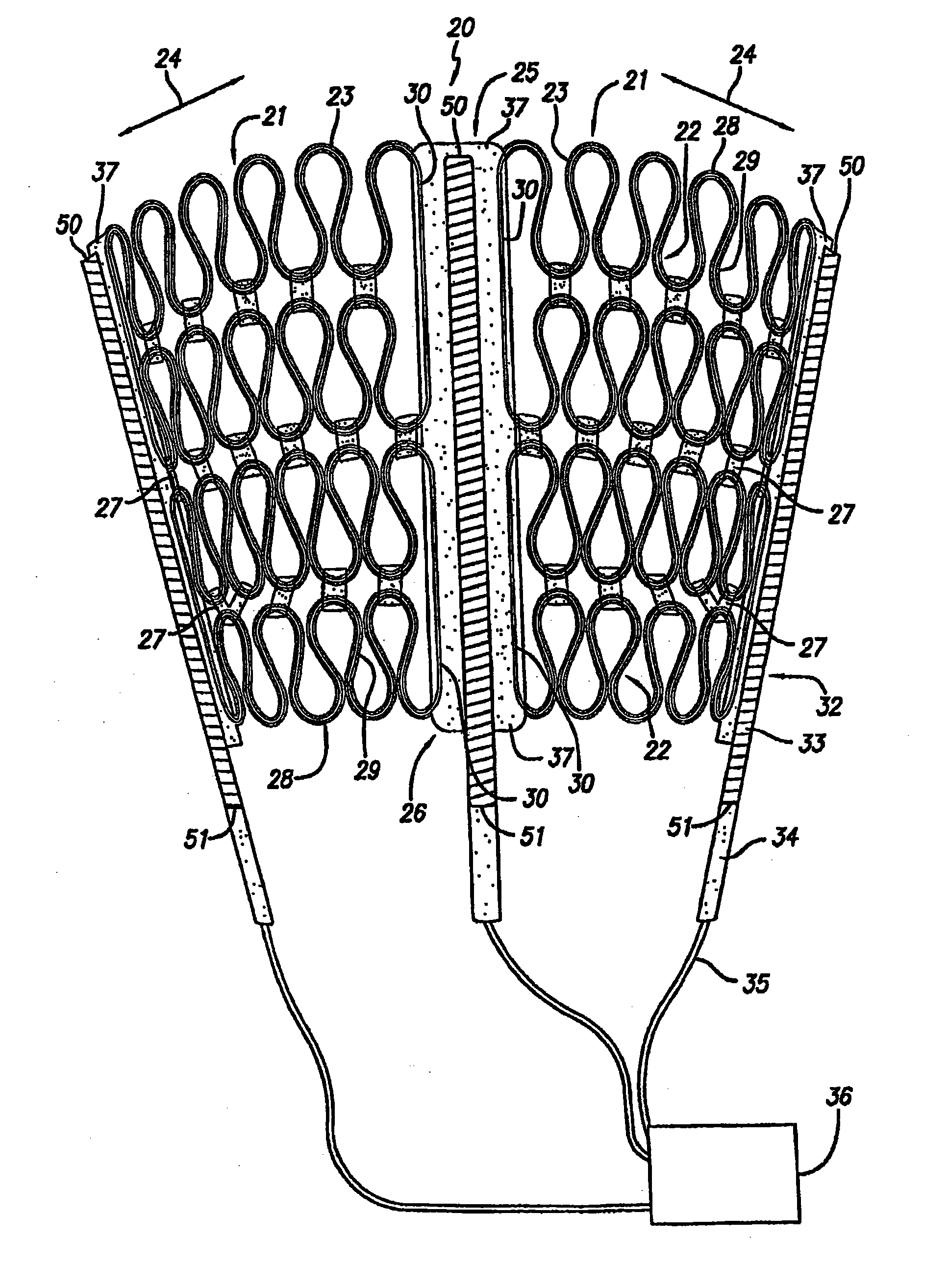 Implantable medical device for drug delivery and method of use