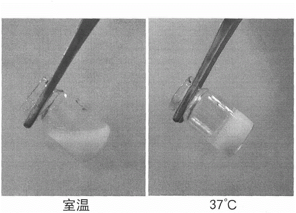Temperature-sensitive in-situ gel preparation composition for anticular injection and preparation method thereof