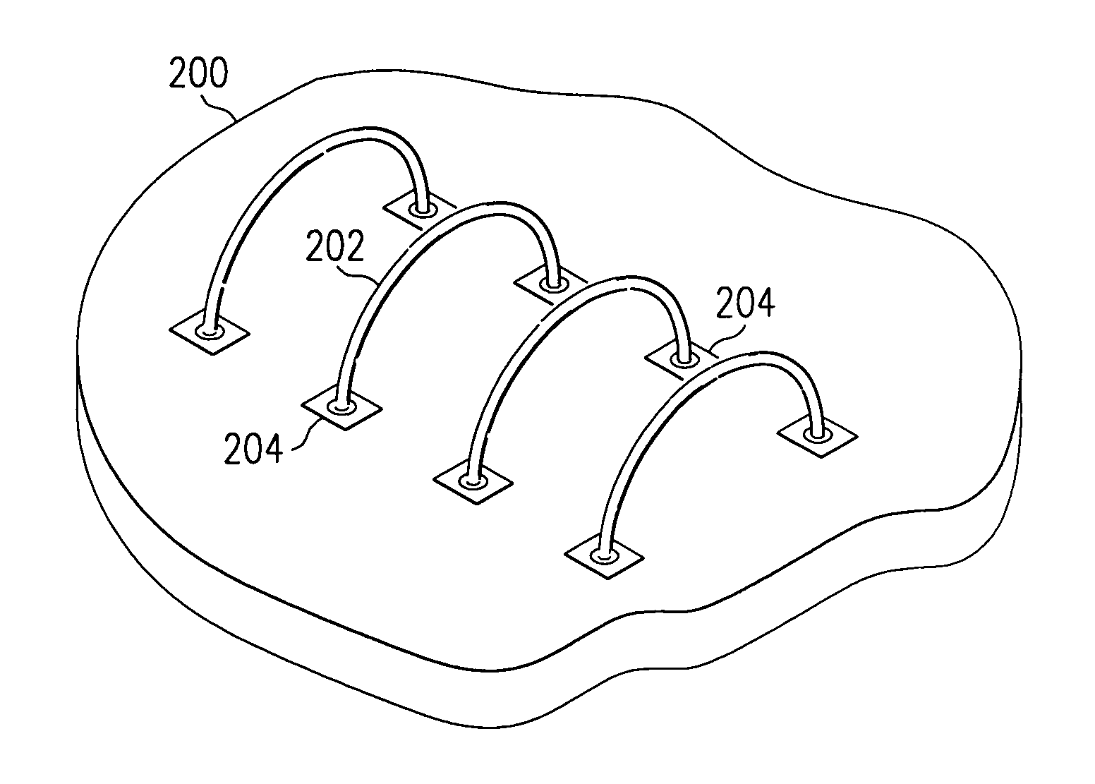 Anchor for device package