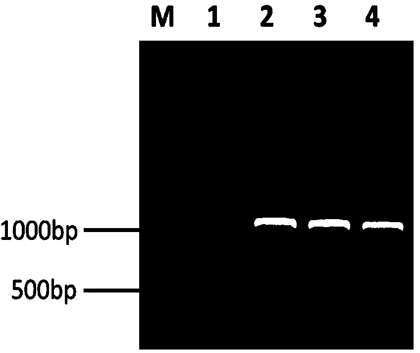 Mortierella alpina, M. alpina genetic engineering strain of overexpression omega 3 desaturase gene and construction method of strain