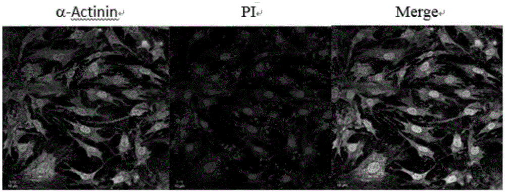 High-purity cardiac muscle cell primary culture method