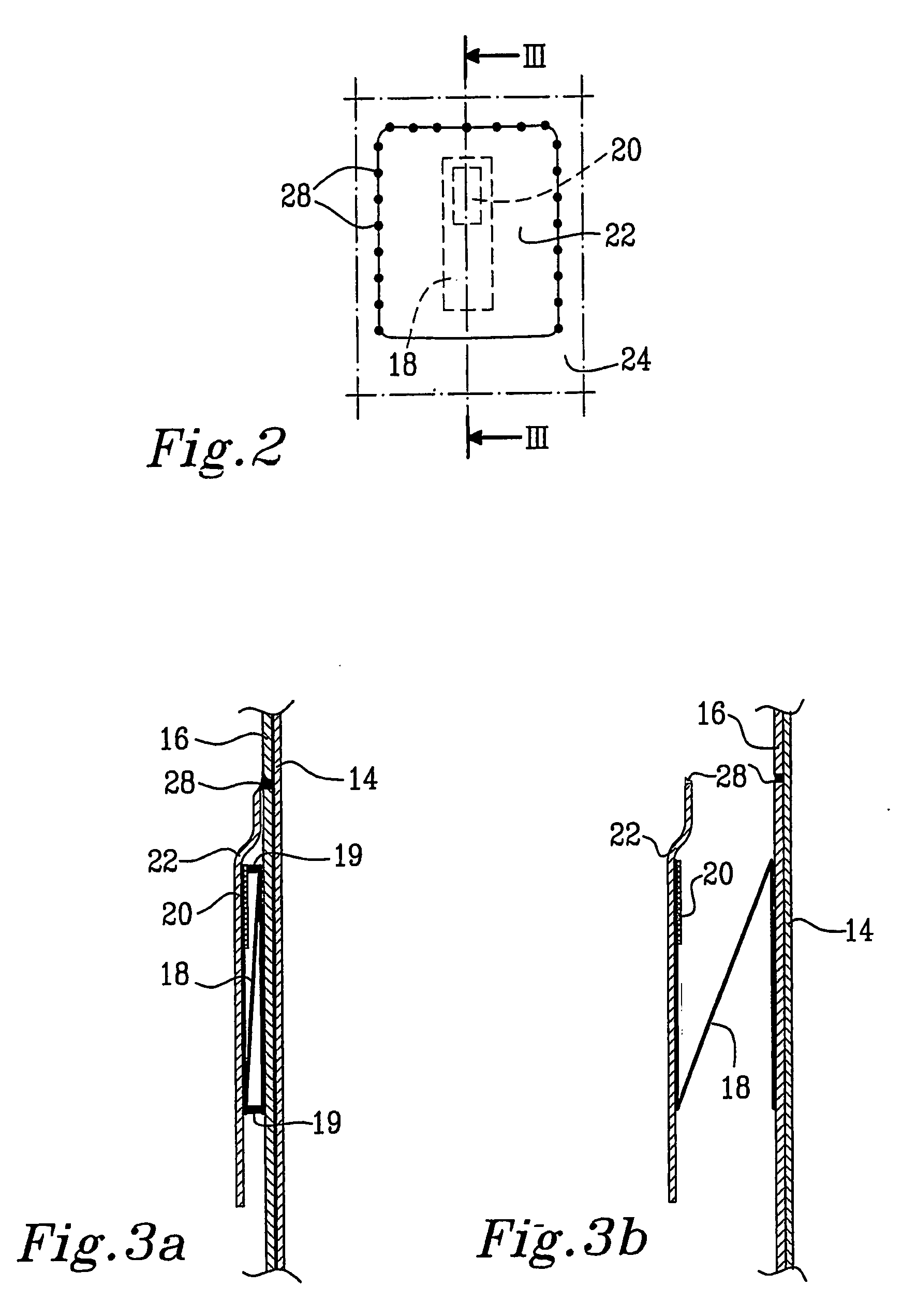 Absorbent article having disposal fastening means