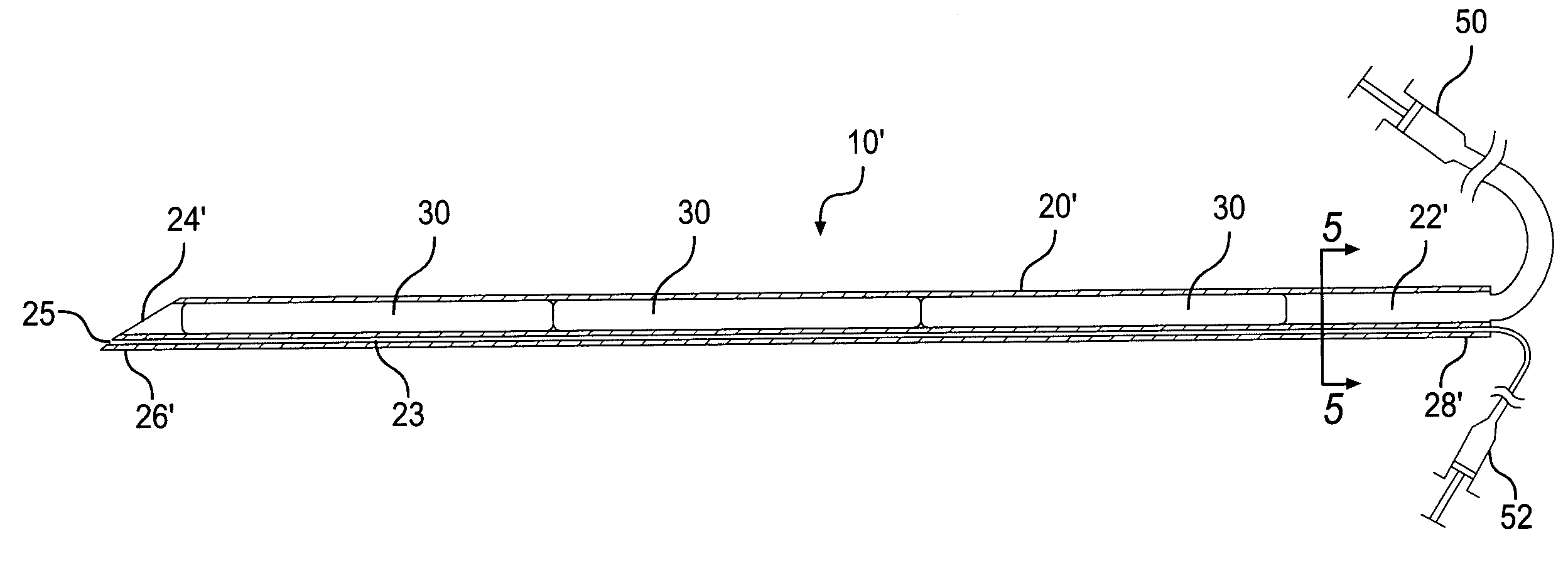 Implant system and method for bulking tissue