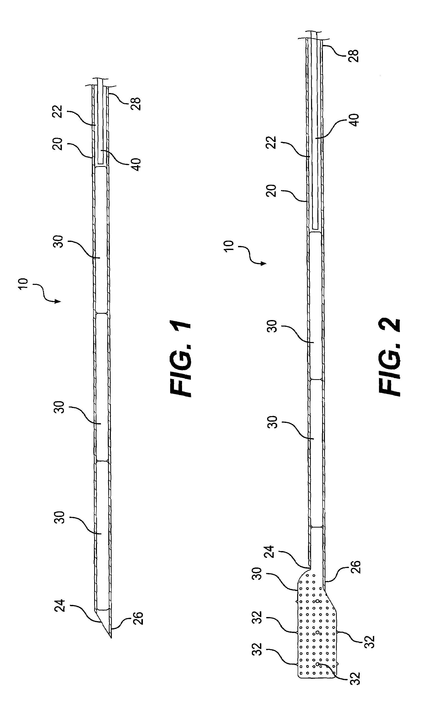 Implant system and method for bulking tissue