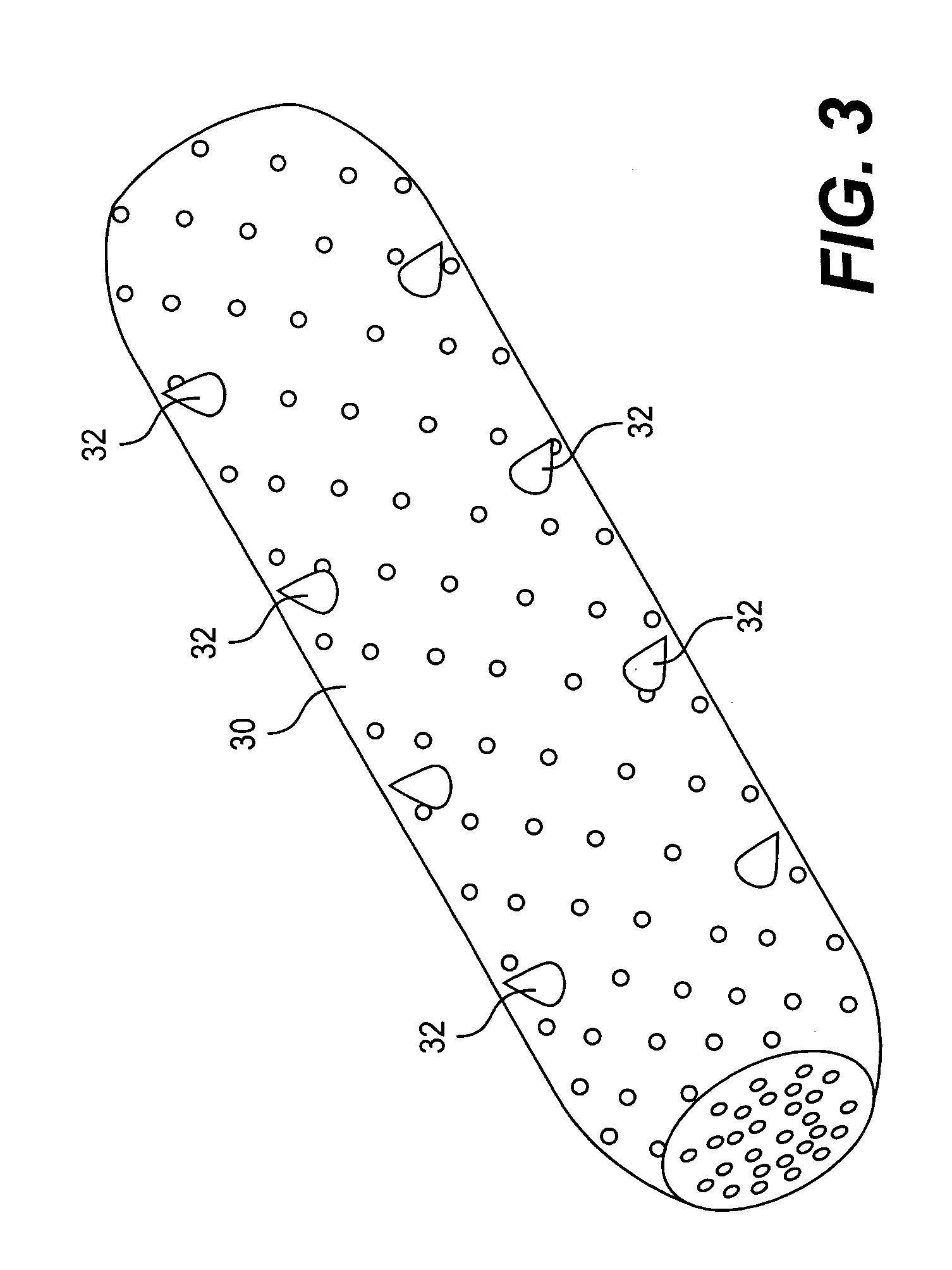 Implant system and method for bulking tissue