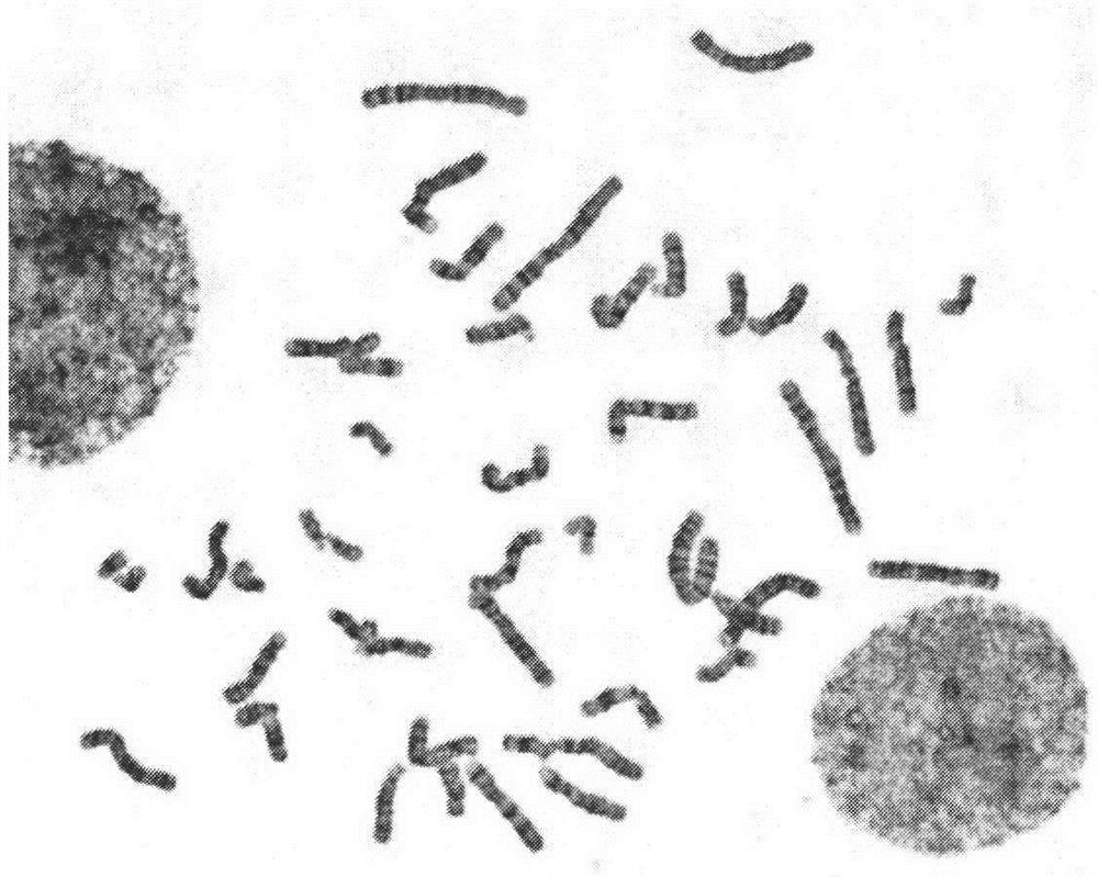 Manufacturing method of peripheral blood chromosome G band