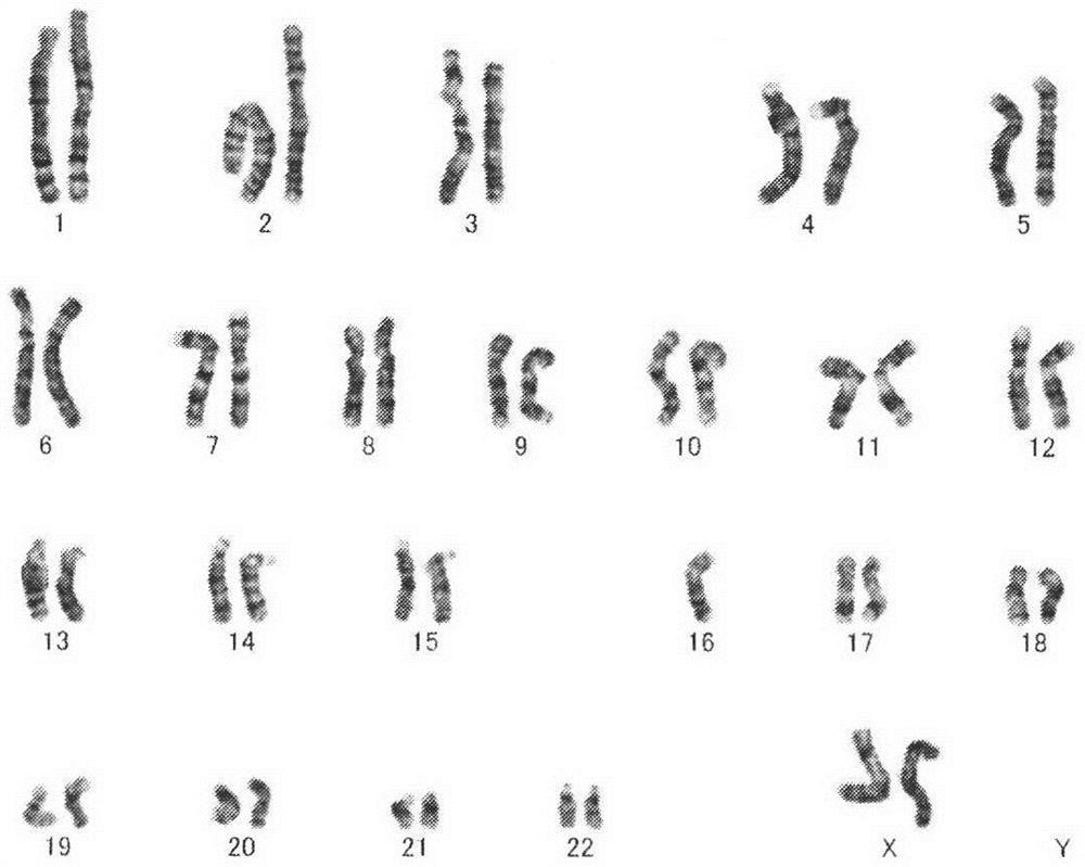 Manufacturing method of peripheral blood chromosome G band