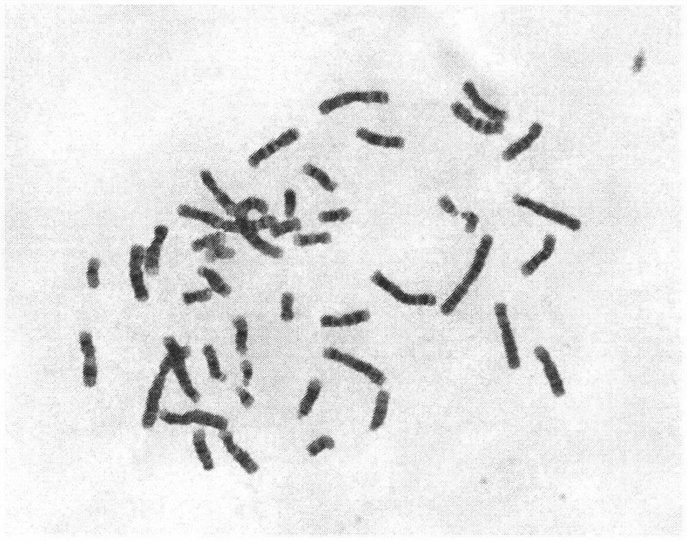 Manufacturing method of peripheral blood chromosome G band