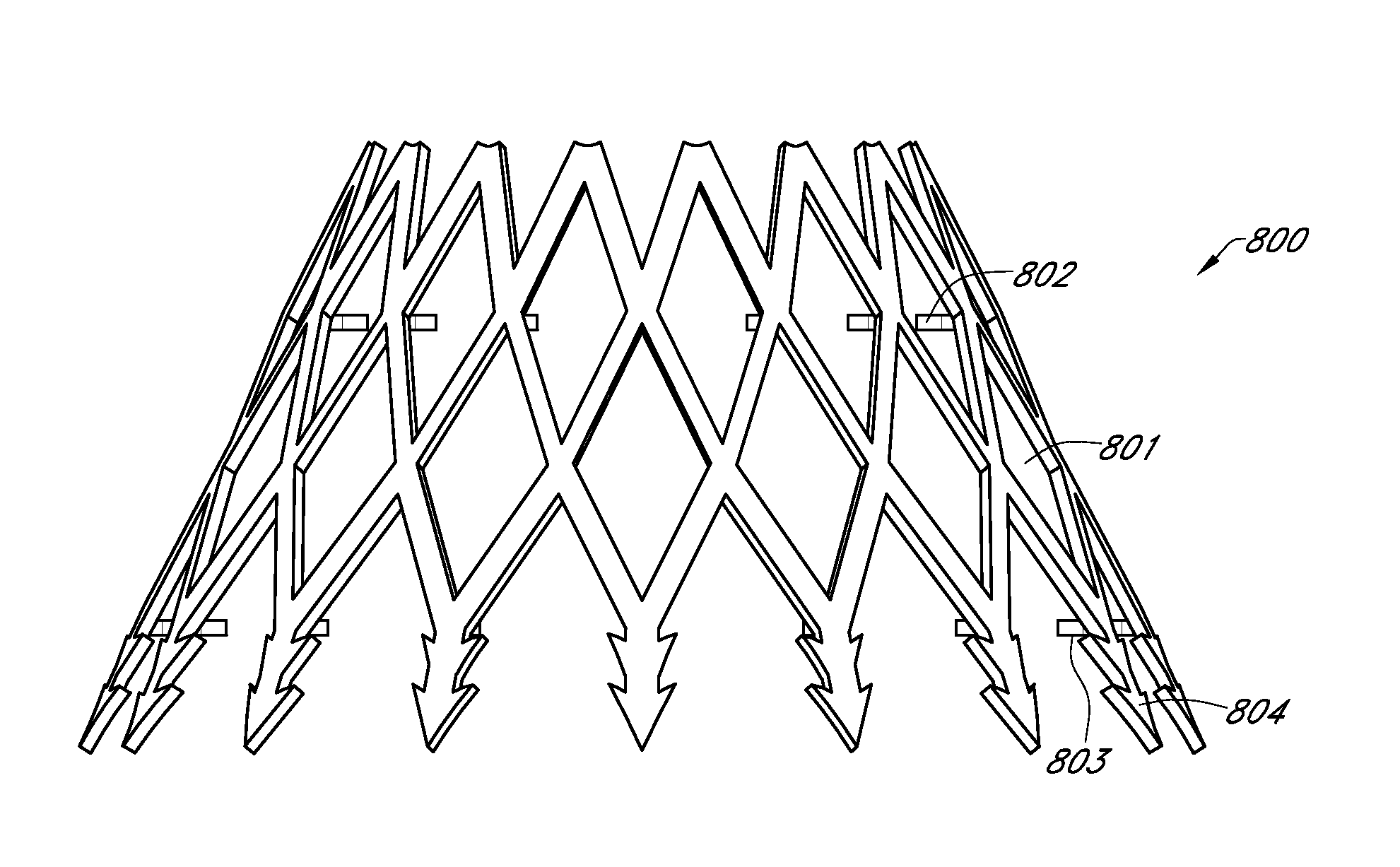 Adjustable endolumenal implant for reshaping the mitral valve annulus