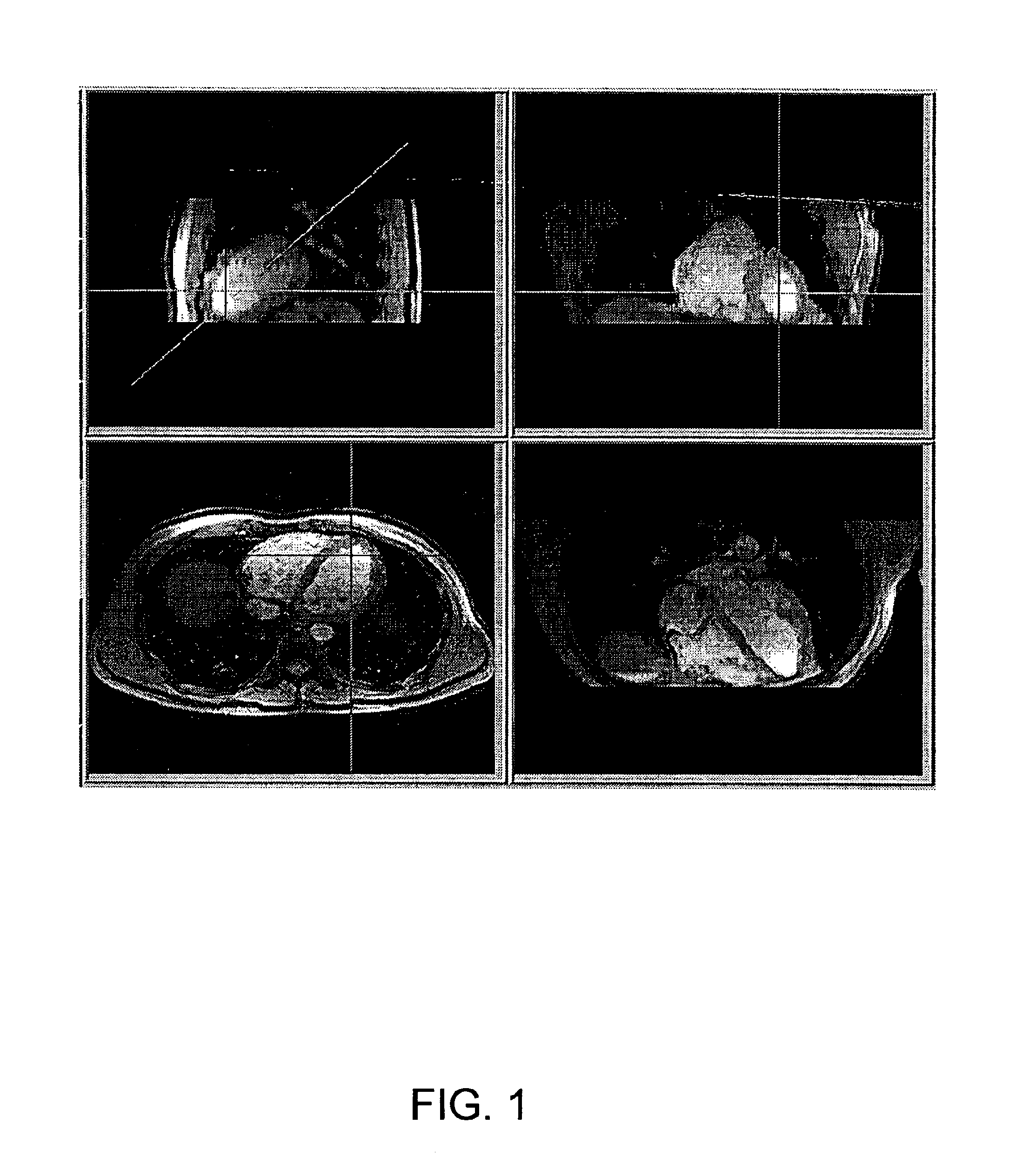 Systems, methods and computer program products for the display and visually driven definition of tomographic image planes in three-dimensional space