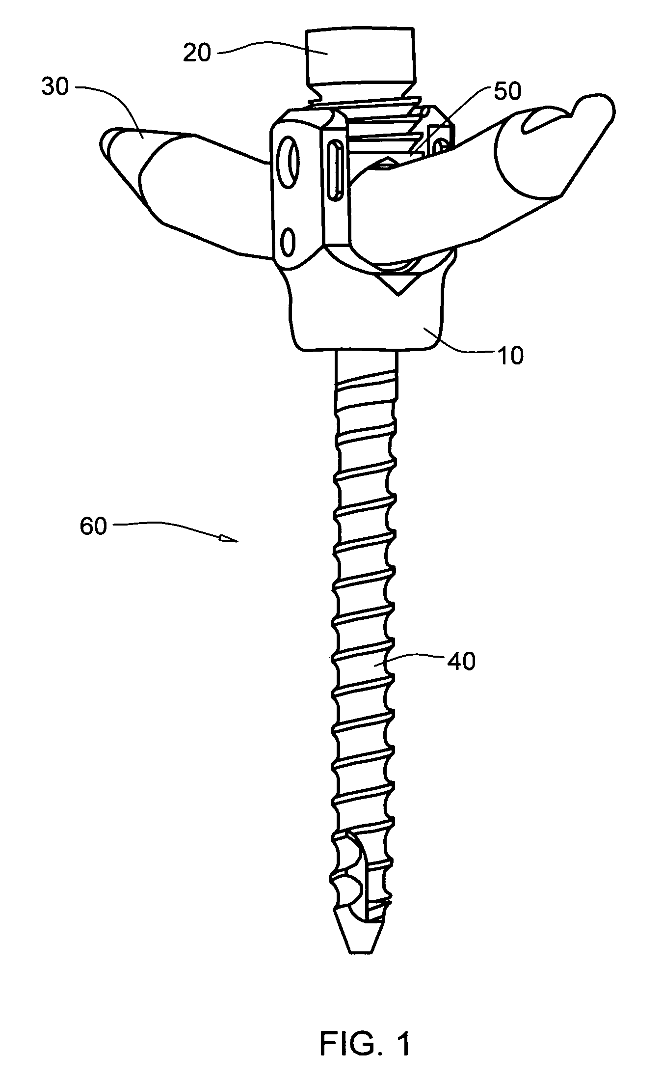 Locking device and method, for use in a bone stabilization system, employing a set screw member and deformable saddle member