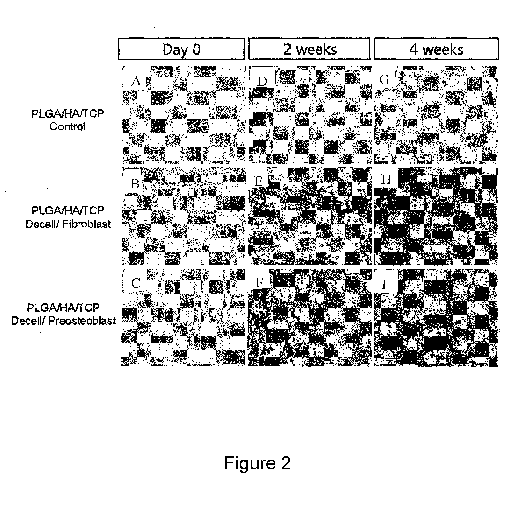 Method for Surface Modification of Polymeric Scaffold for Stem Cell Transplantation Using Decellularized Extracellular Matrix