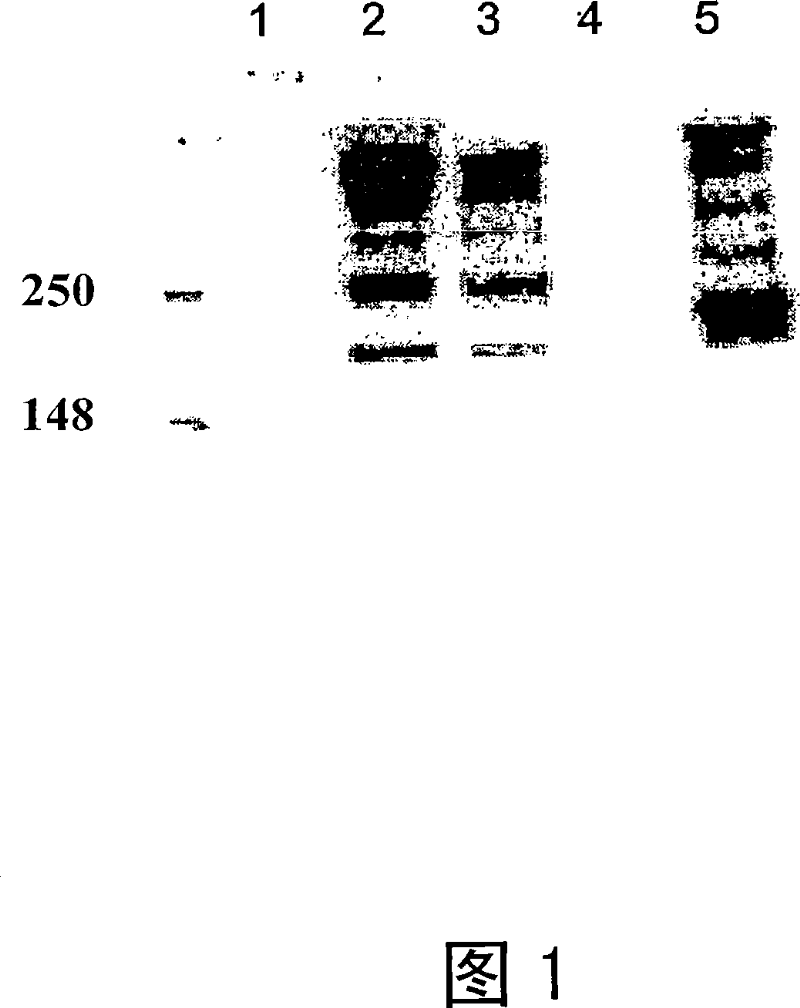 Nucleic acids, polypeptides, methods of expression, and immunogenic compositions associated with sars corona virus spike protein