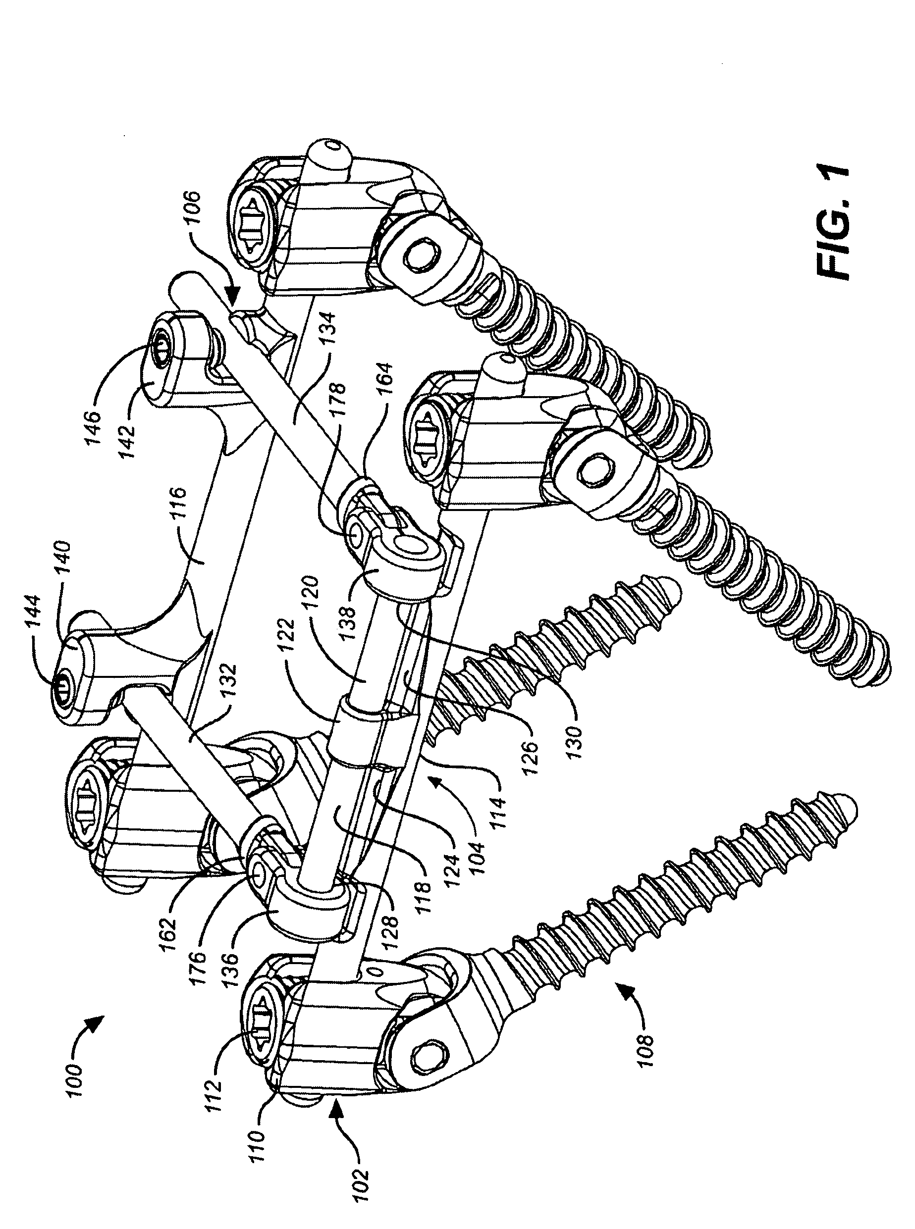 Method for implanting a deflection rod system and customizing the deflection rod system for a particular patient need for dynamic stabilization and motion preservation spinal implantation system