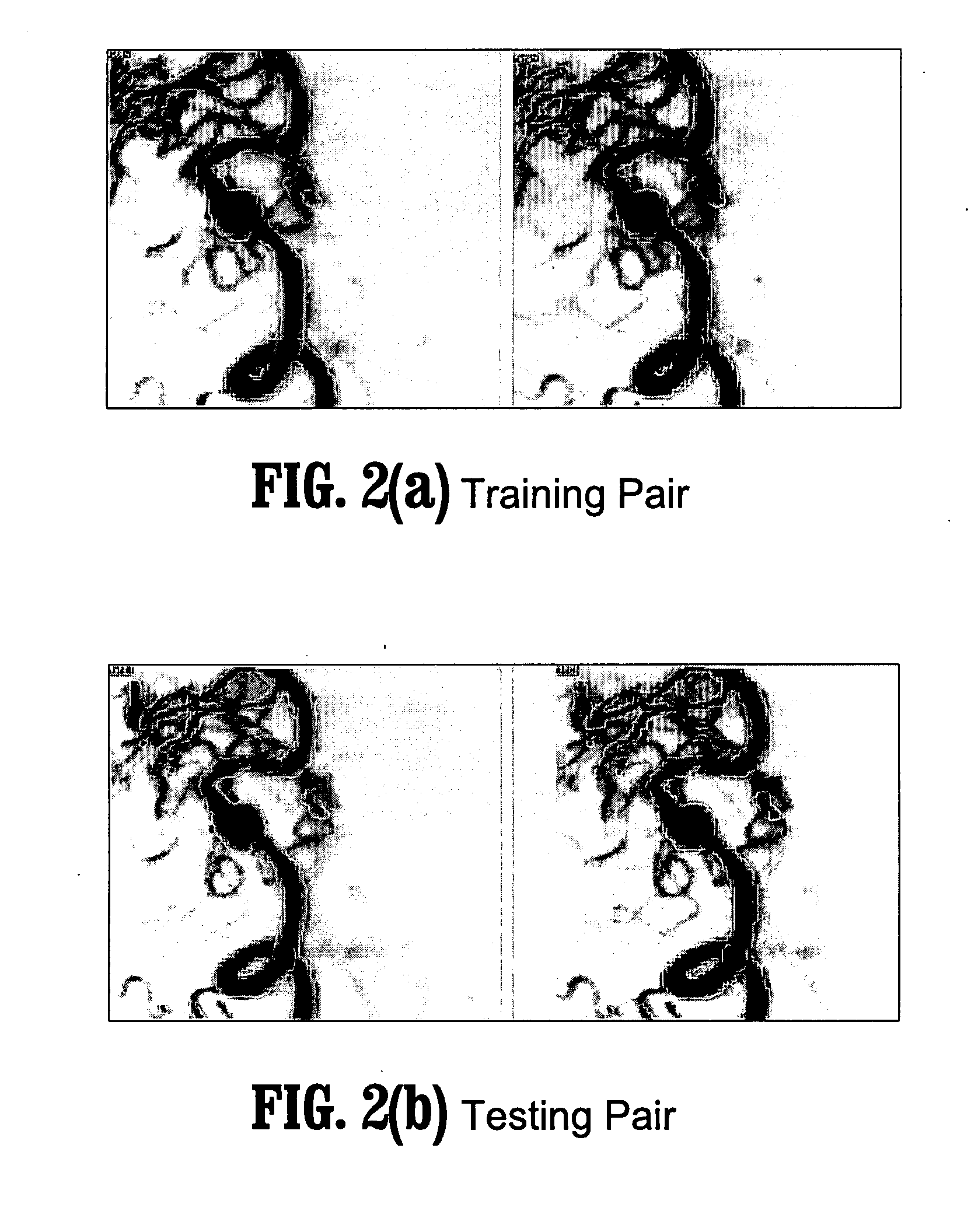 System and method for learning-based 2d/3d rigid registration for image-guided surgery