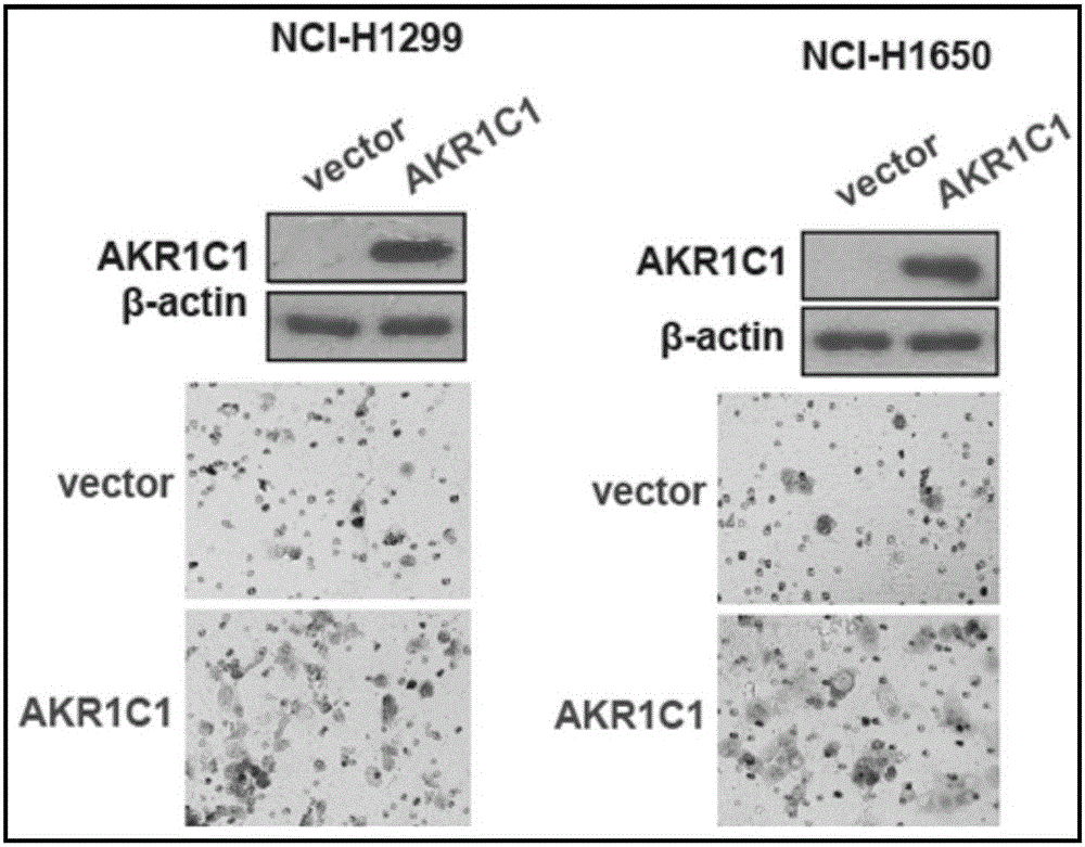 Application of AKR1C1 protein