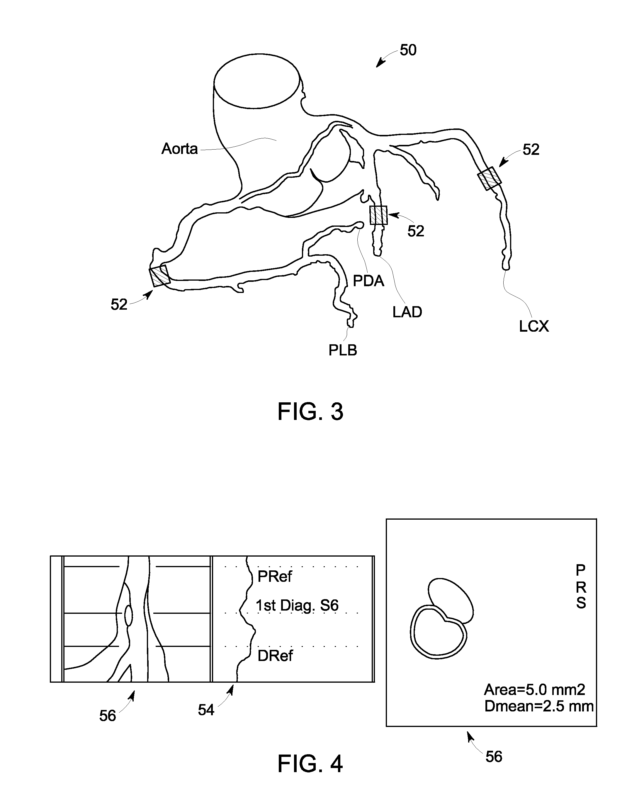 System and method for blood vessel stenosis visualization and navigation