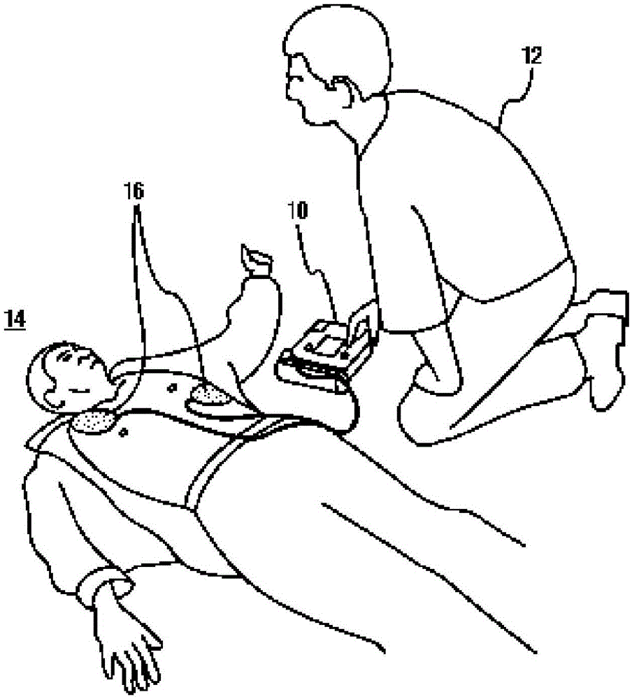 Method and apparatus for scoring the reliability of shock advisory during cardiopulmonary resuscitation