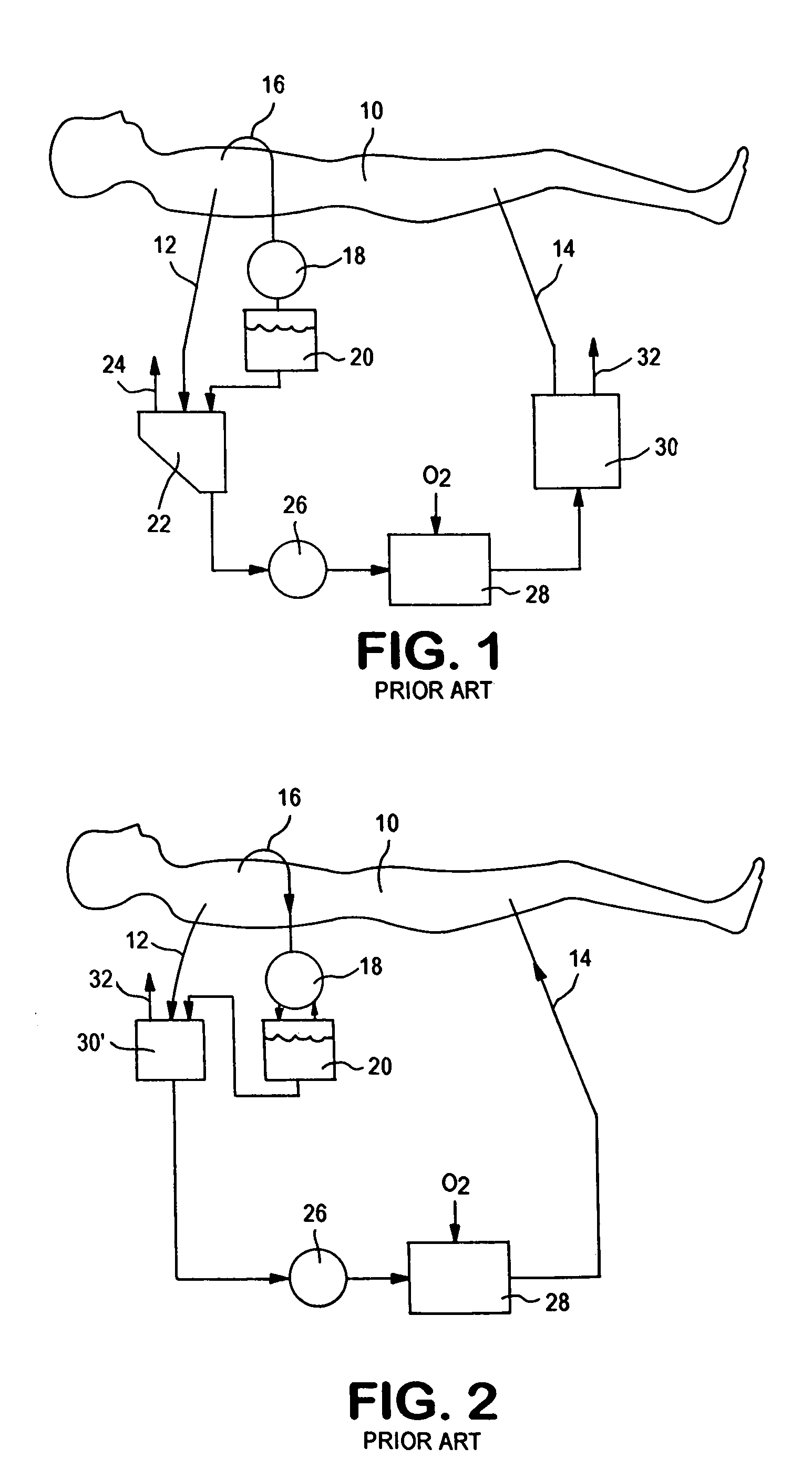 Extracorporeal blood circuit priming system and method