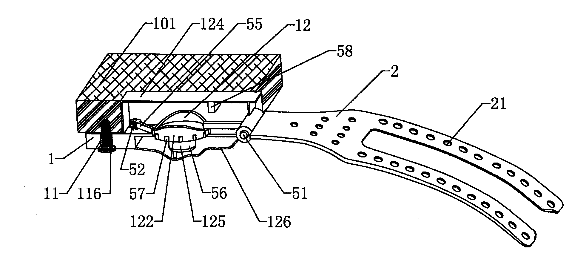 Adjustable Support for Soft Palate and Implanting Method Thereof