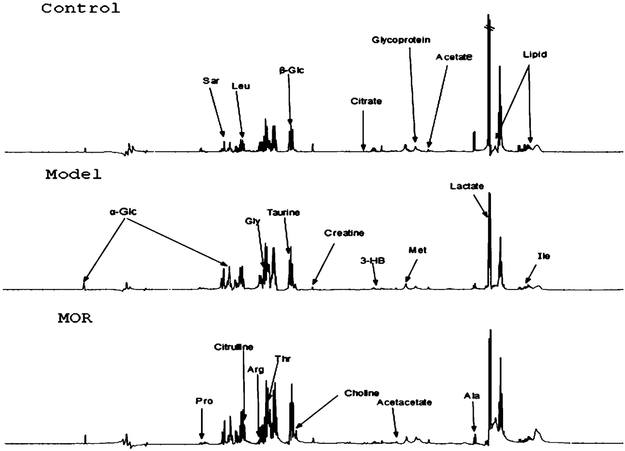Metabolic pathway of moringa oleifera seed antidiabetic serum potential markers based on metabonomics and research method
