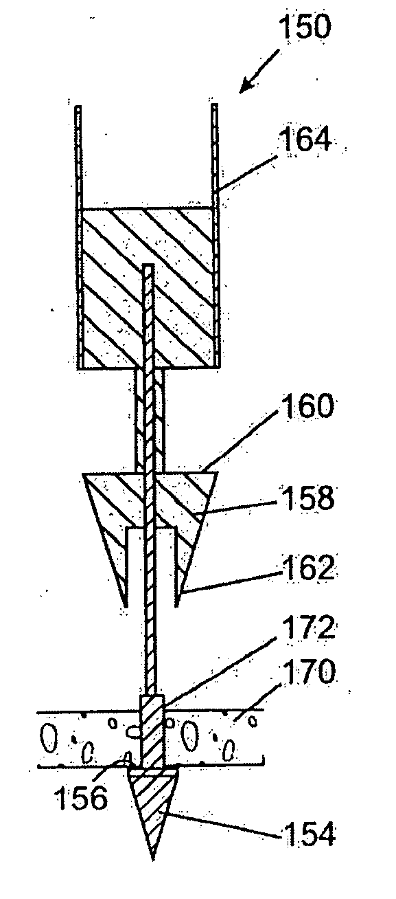 Surgical method for treating a vessel wall