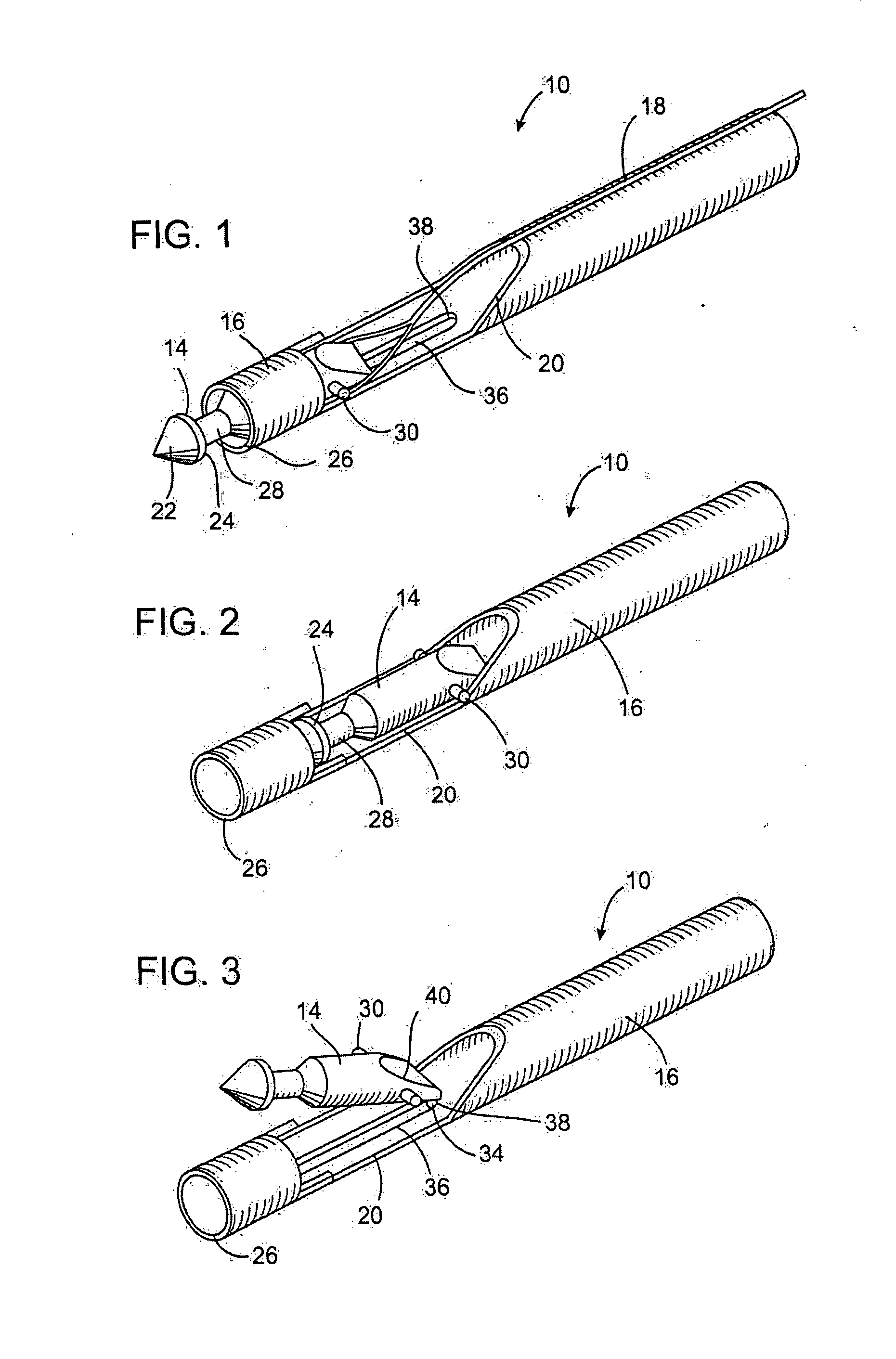 Surgical method for treating a vessel wall