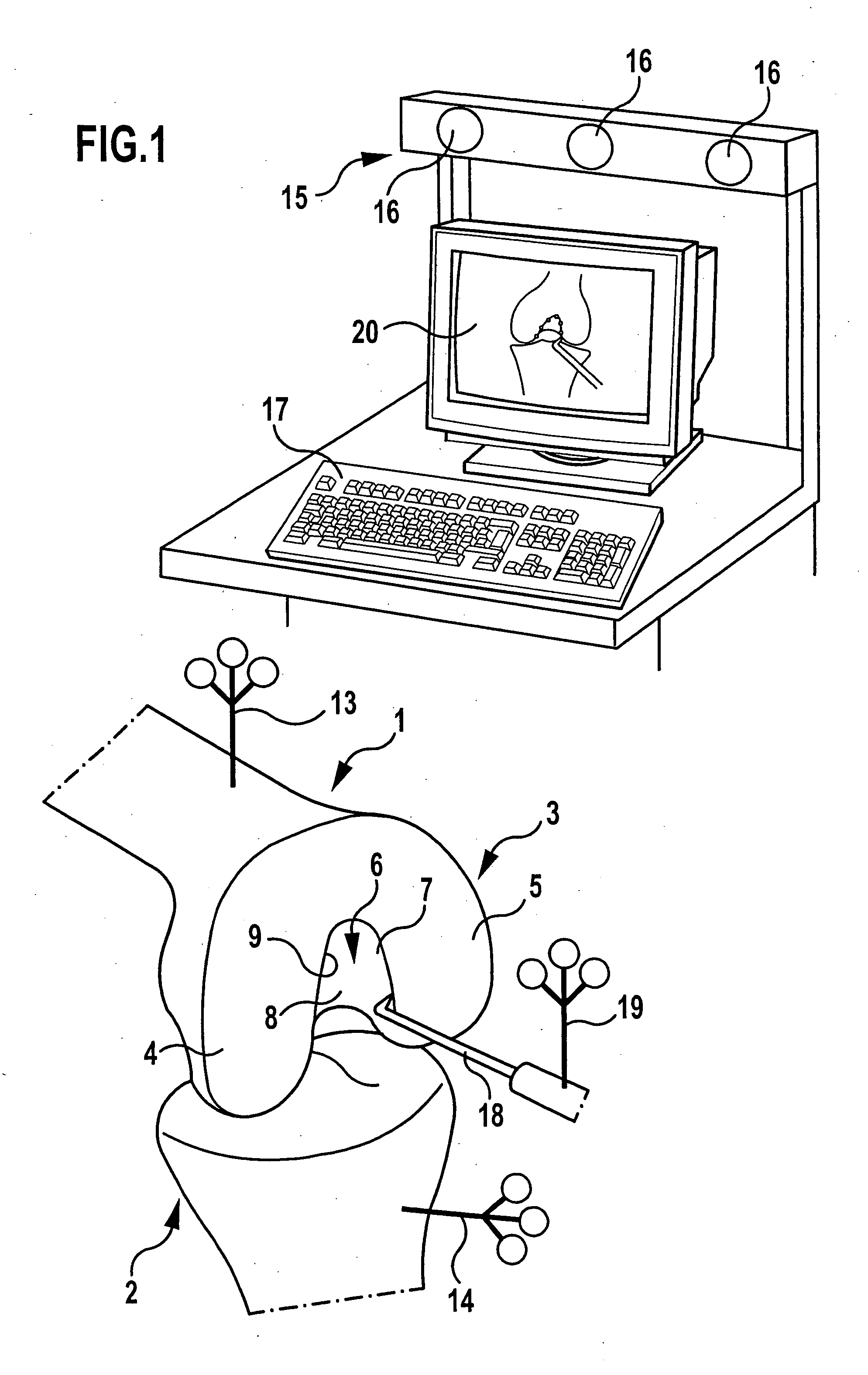 Method and apparatus for determining the position of the tibial exit point of the anterior cruciate ligament