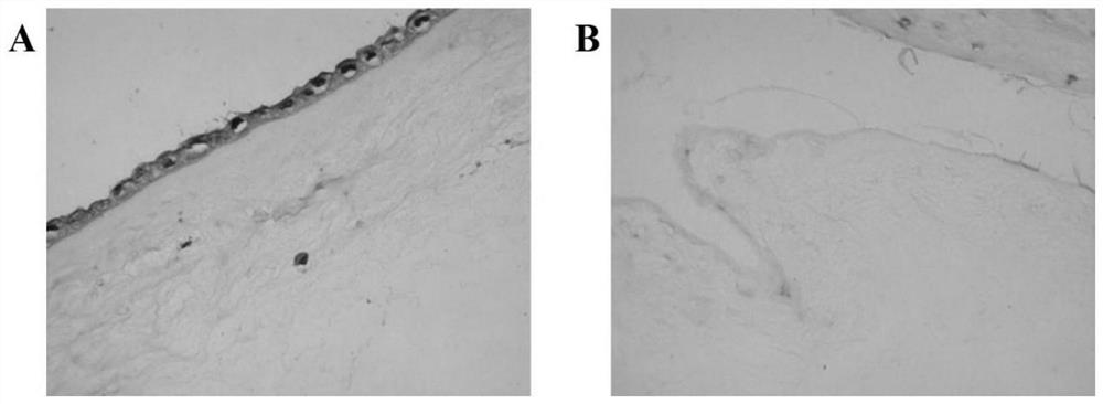 Preparation method of acellular amniotic uterine cavity stent loaded with estradiol microspheres