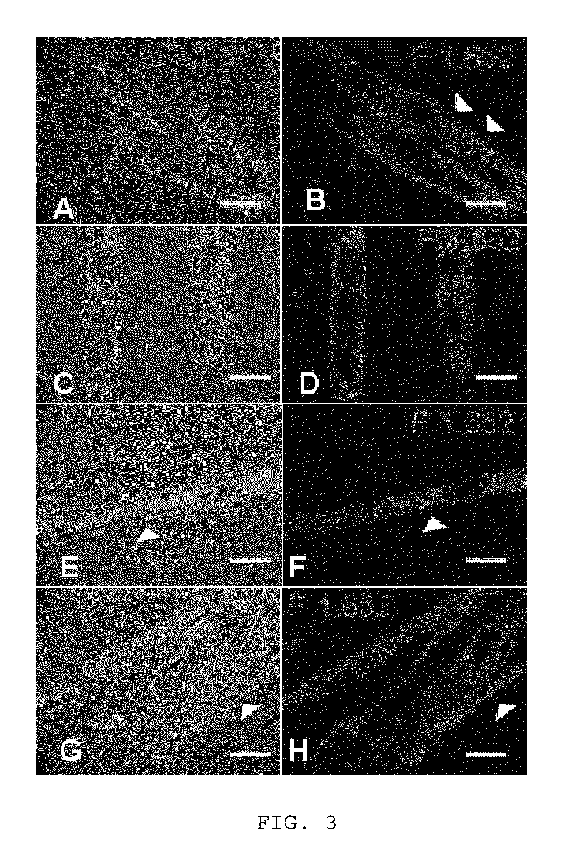 Method for culturing skeletal muscle for tissue engineering