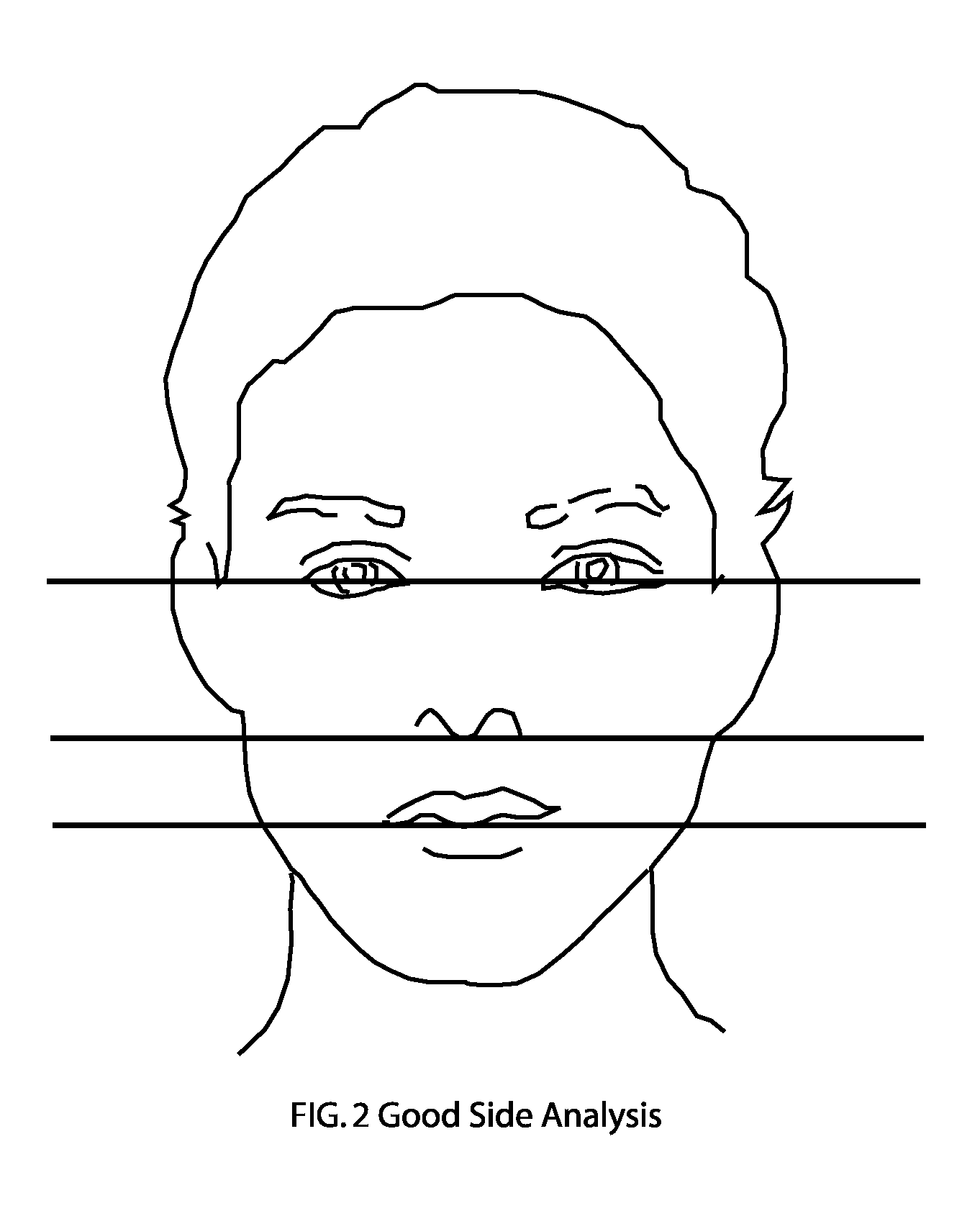 Methods Of Analyzing Human Facial Symmetry And Balance To Provide Beauty Advice