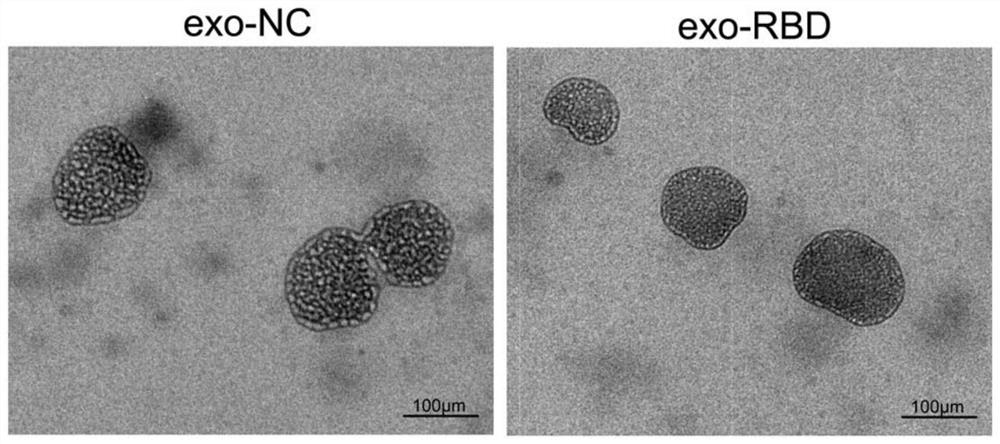 Targeting exosome based on RBD region of SARS-CoV-2 S protein and preparation method of targeting exosome