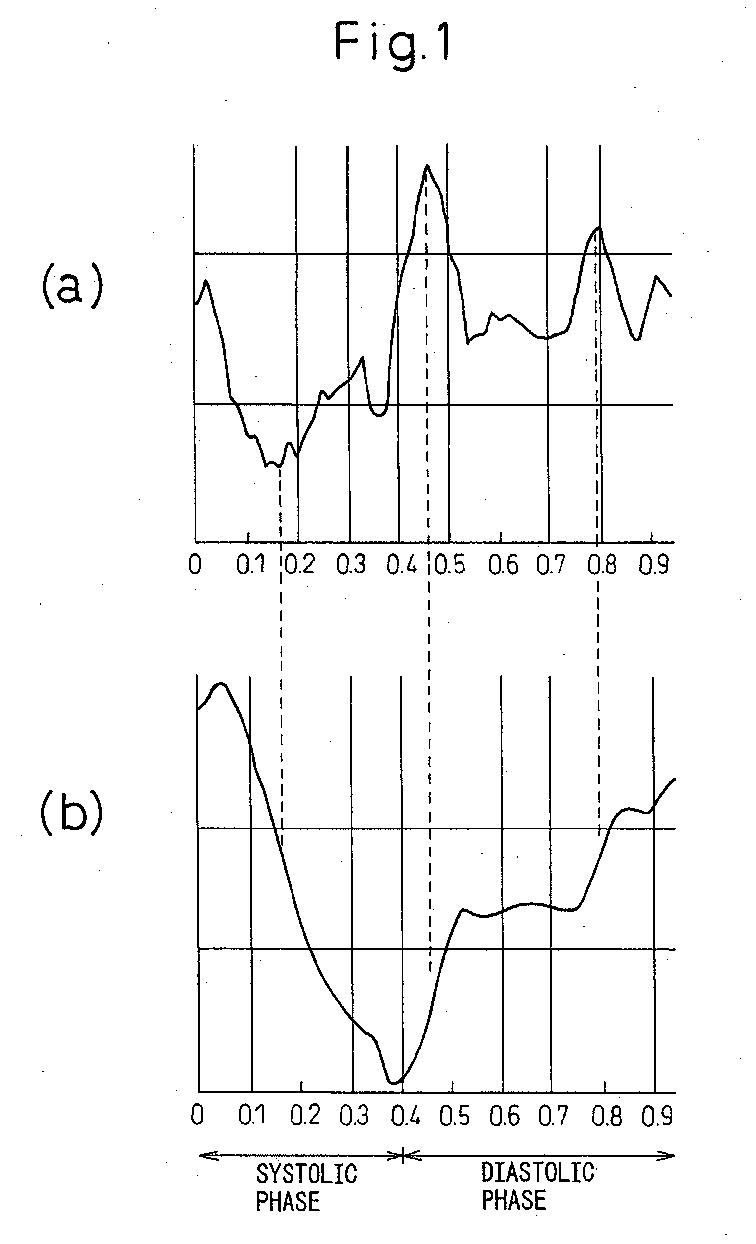 Apparatus and method for diagnosing ischemic heart disease